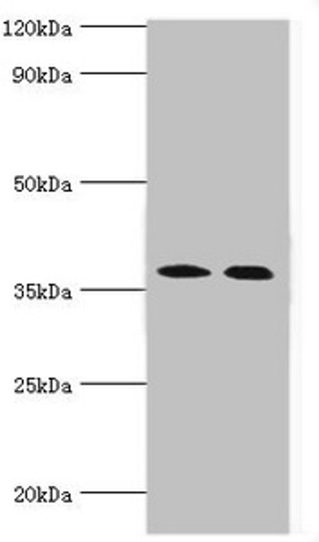 Western blot. All lanes: Carbonic anhydrase 14 antibody at 5ug/ml. Lane 1: Mouse liver tissue. Lane 2: Jurkat whole cell lysate. Secondary. Goat polyclonal to rabbit IgG at 1/10000 dilution. Predicted band size: 38 kDa. Observed band size: 38 kDa. 