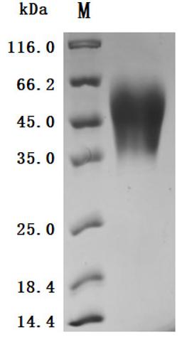 (Tris-Glycine gel) Discontinuous SDS-PAGE (reduced) with 5% enrichment gel and 15% separation gel.