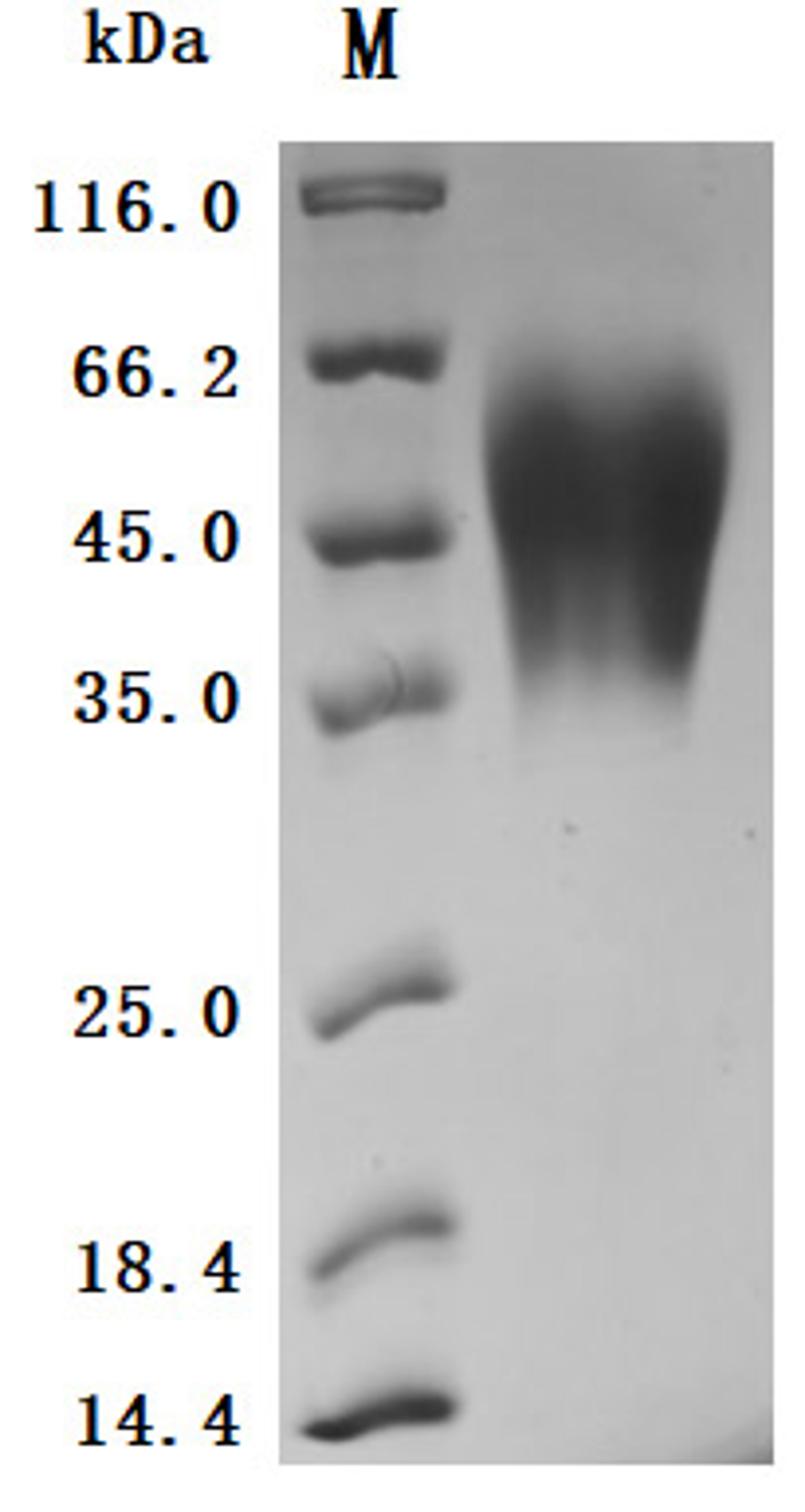 (Tris-Glycine gel) Discontinuous SDS-PAGE (reduced) with 5% enrichment gel and 15% separation gel.