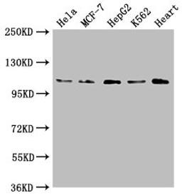 Western Blot. Positive WB detected in: Hela whole cell lysate, MCF-7 whole cell lysate, HepG2 whole cell lysate, K562 whole cell lysate, Mouse heart tissue. All lanes: OPA1 antibody at 1:2000. Secondary. Goat polyclonal to rabbit IgG at 1/50000 dilution. Predicted band size: 112, 116 kDa. Observed band size: 112 kDa. 