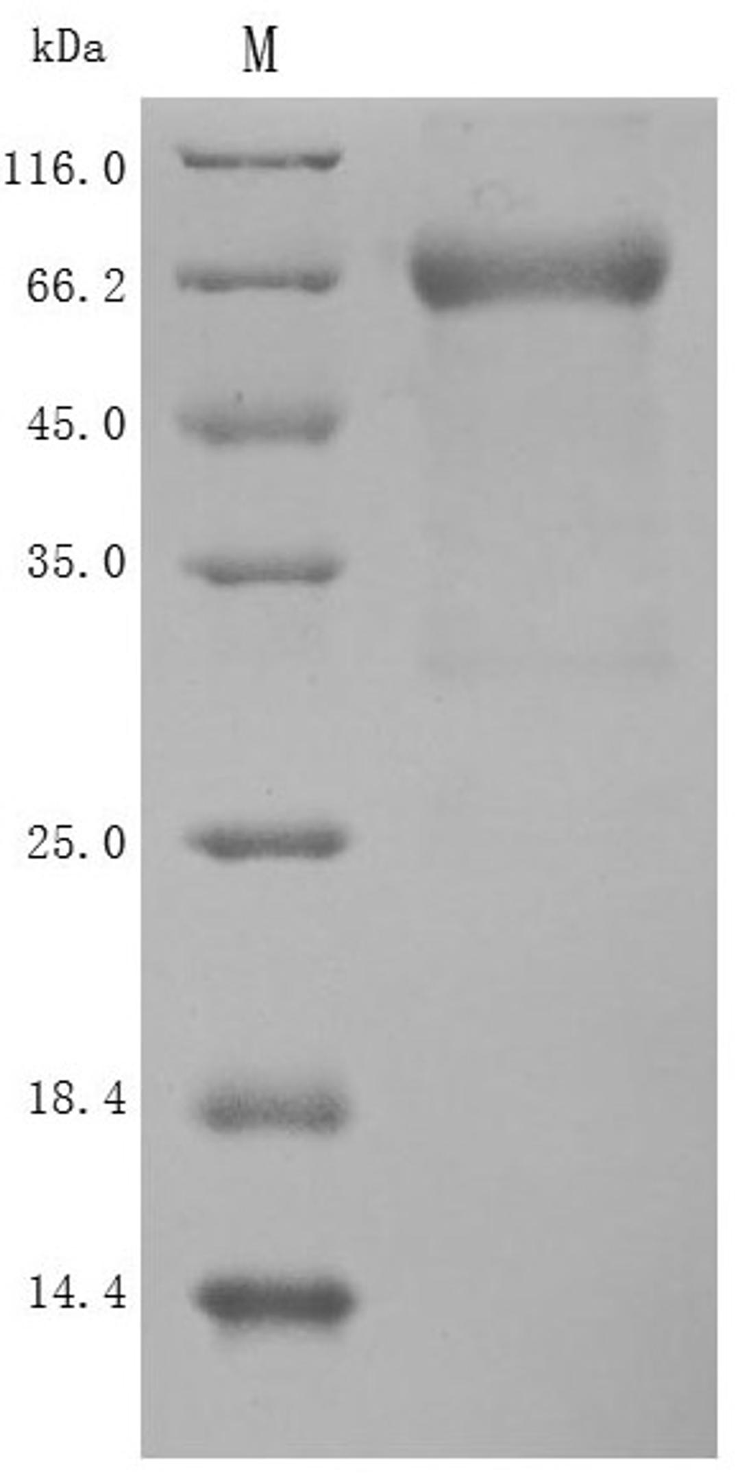 (Tris-Glycine gel) Discontinuous SDS-PAGE (reduced) with 5% enrichment gel and 15% separation gel.