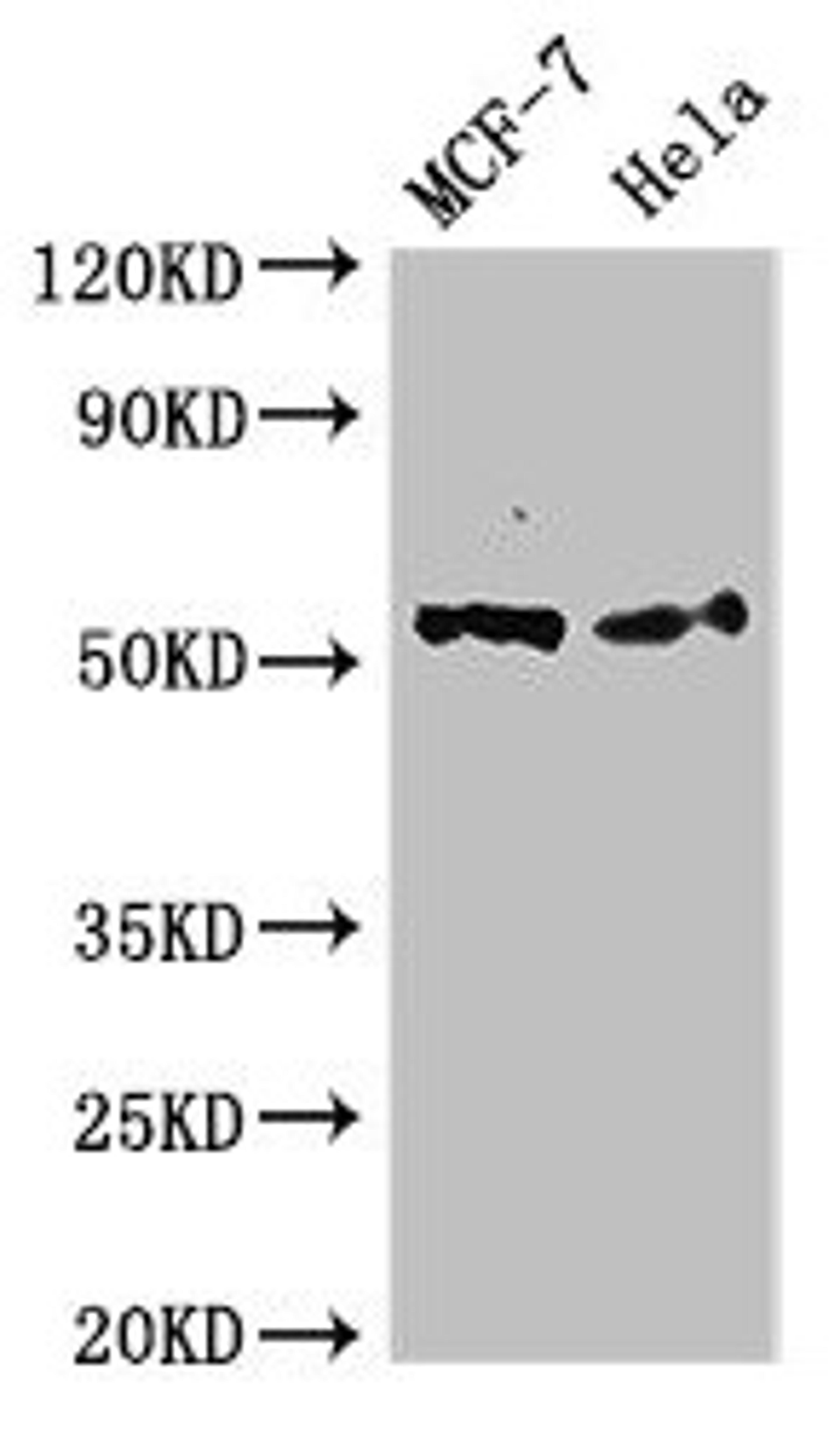 Western Blot. Positive WB detected in: MCF-7 whole cell lysate, Hela whole cell lysate. All lanes: PTK6 antibody at 2.4µg/ml. Secondary. Goat polyclonal to rabbit IgG at 1/50000 dilution. Predicted band size: 52, 15 kDa. Observed band size: 52 kDa