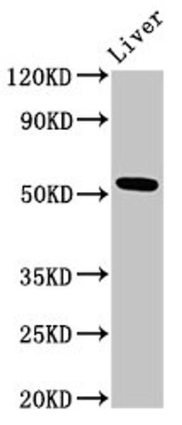 Western Blot. Positive WB detected in: Rat liver tissue. All lanes: METAP2 antibody at 3ug/ml. Secondary. Goat polyclonal to rabbit IgG at 1/50000 dilution. Predicted band size: 53, 52, 51 kDa. Observed band size: 53 kDa. 