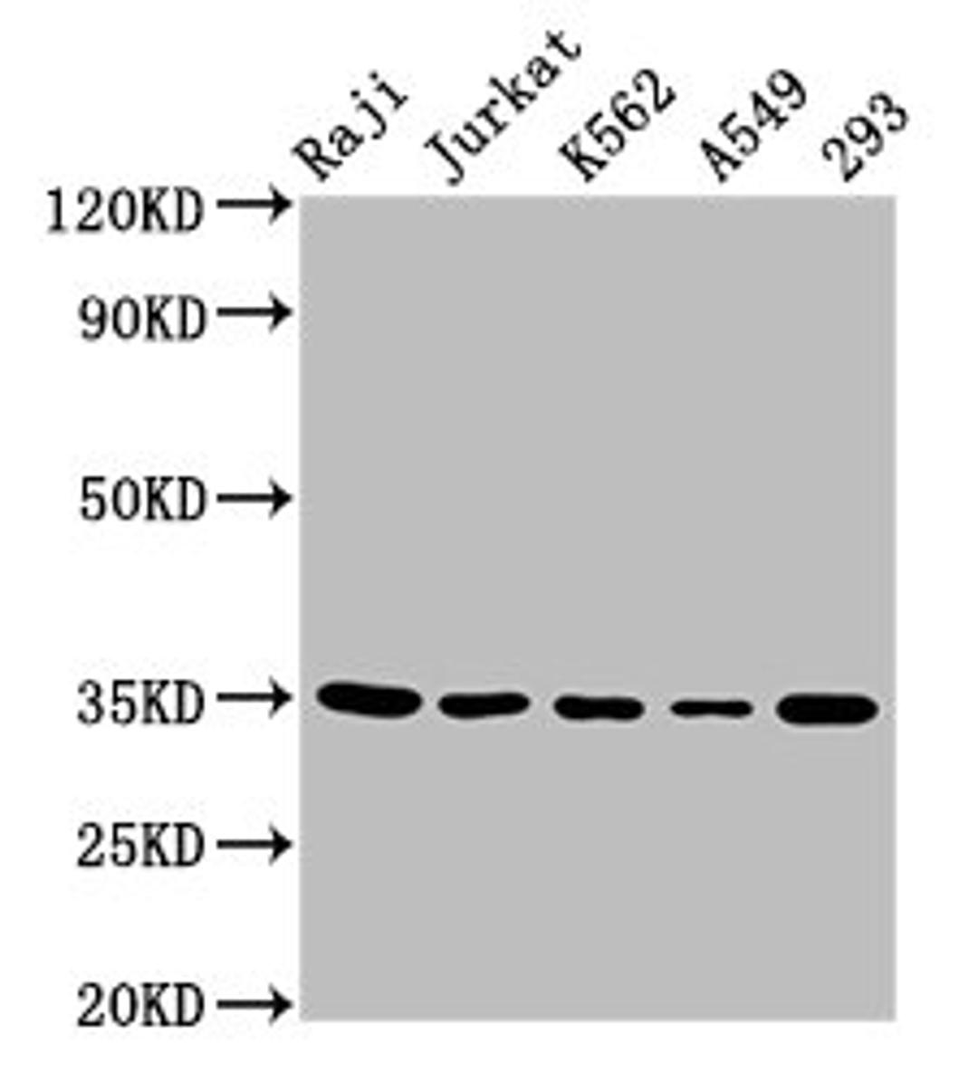 Western Blot. Positive WB detected in: Raji whole cell lysate, Jurkat whole cell lysate, K562 whole cell lysate, A549 whole cell lysate, 293 whole cell lysate. All lanes: TAL1 antibody at 5.5µg/ml. Secondary. Goat polyclonal to rabbit IgG at 1/50000 dilution. Predicted band size: 35, 32, 17 kDa. Observed band size: 35 kDa