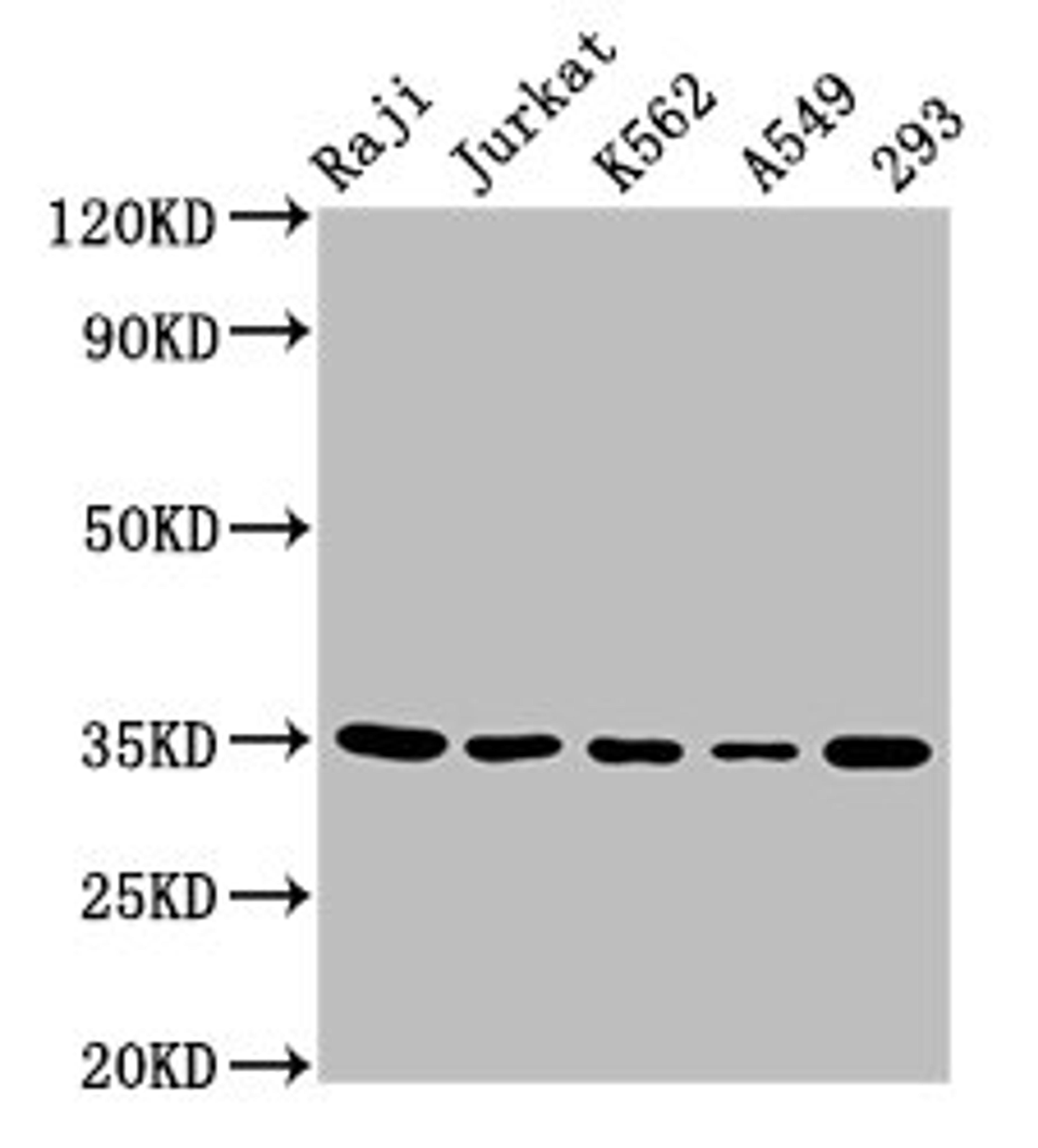Western Blot. Positive WB detected in: Raji whole cell lysate, Jurkat whole cell lysate, K562 whole cell lysate, A549 whole cell lysate, 293 whole cell lysate. All lanes: TAL1 antibody at 5.5µg/ml. Secondary. Goat polyclonal to rabbit IgG at 1/50000 dilution. Predicted band size: 35, 32, 17 kDa. Observed band size: 35 kDa