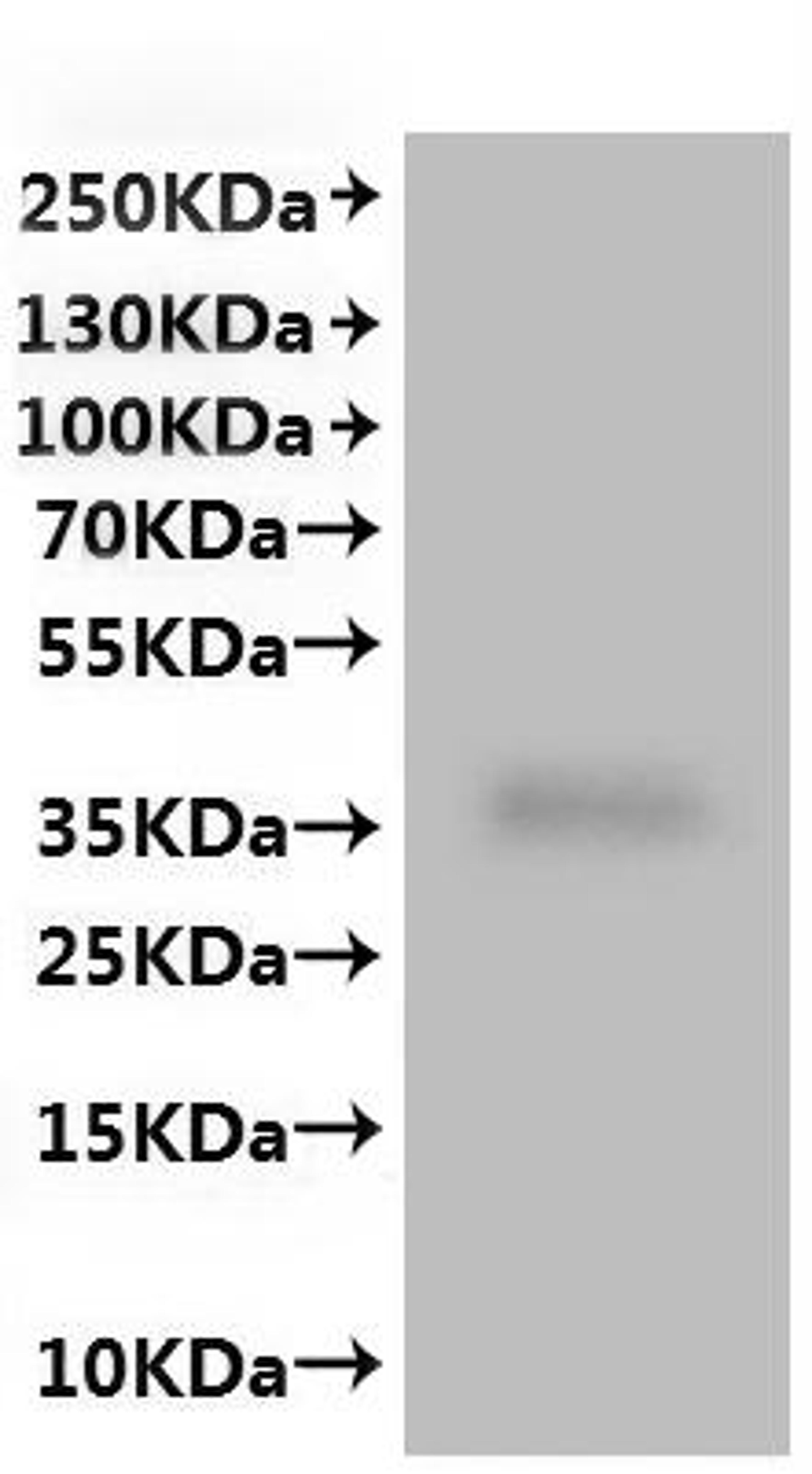 CSB-MP622519HU(A4) is detected by Mouse anti-6*His monoclonal antibody.
