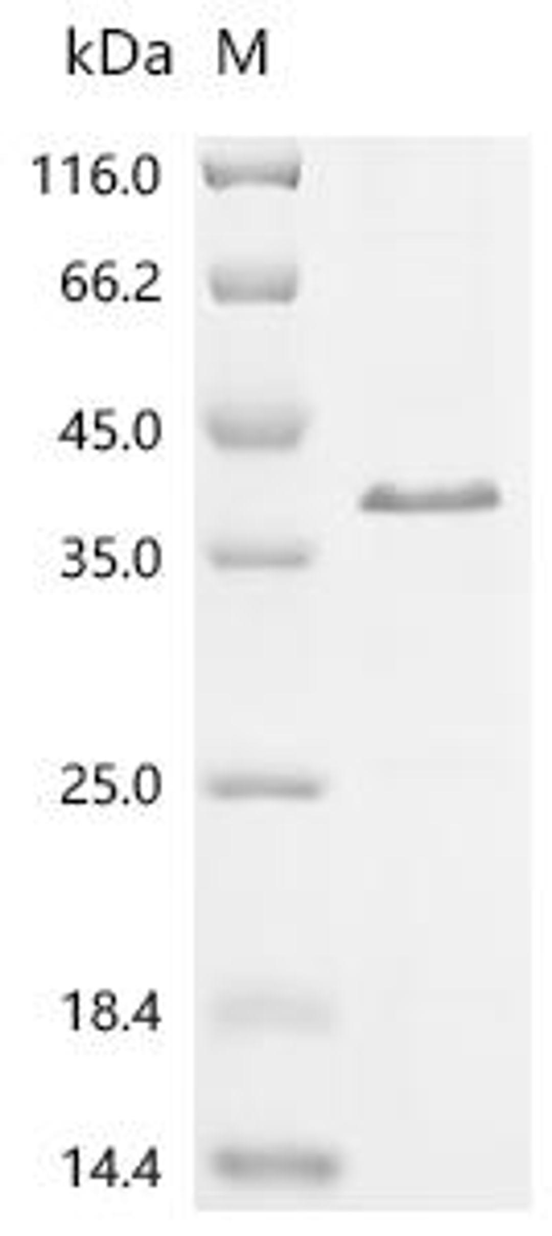(Tris-Glycine gel) Discontinuous SDS-PAGE (reduced) with 5% enrichment gel and 15% separation gel.