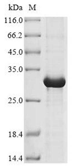 (Tris-Glycine gel) Discontinuous SDS-PAGE (reduced) with 5% enrichment gel and 15% separation gel.