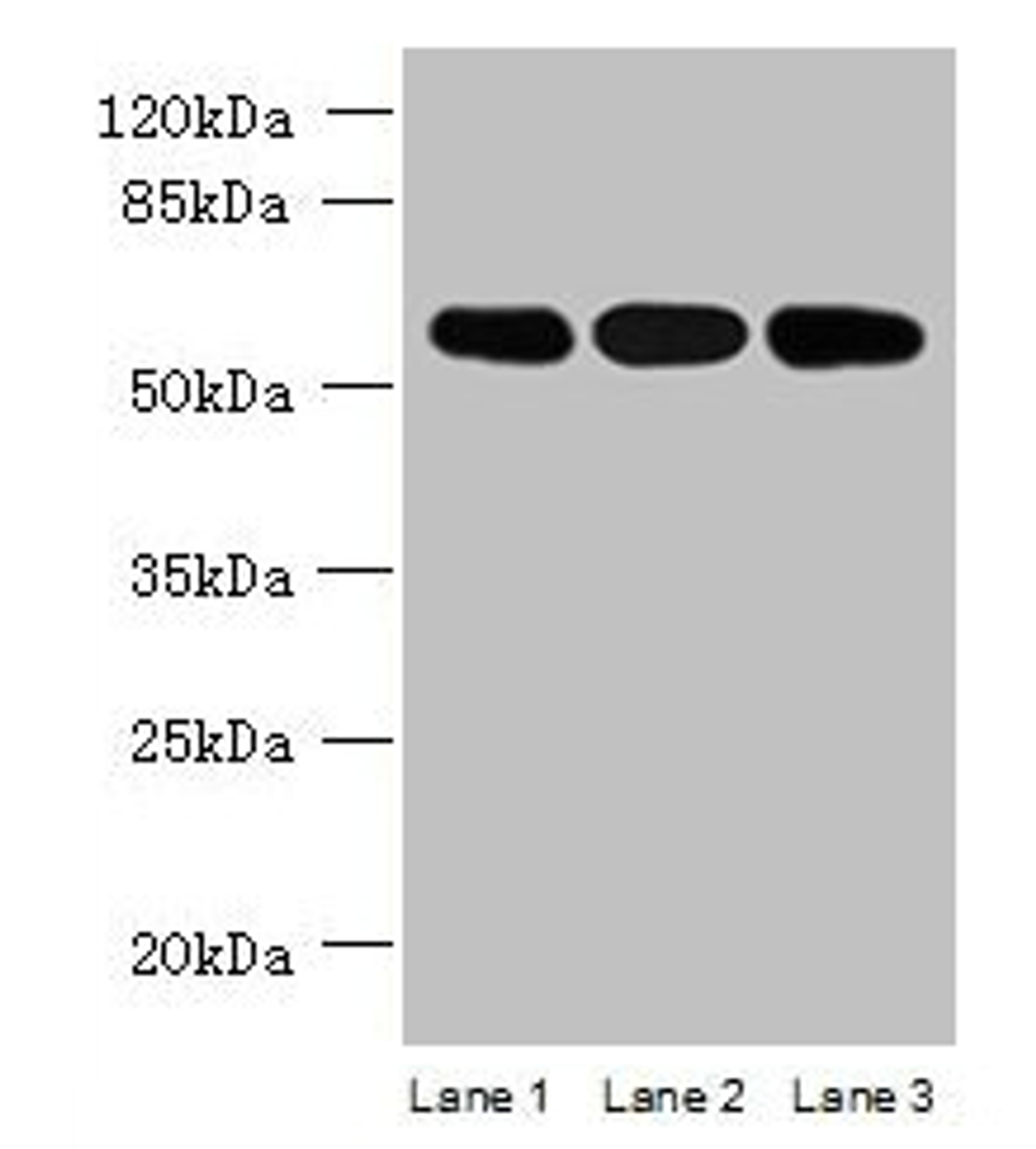 Western blot. All lanes: STK33 antibody at 4µg/ml. Lane 1: Mouse kidney tissue. Lane 2: Hela whole cell lysate. Lane 3: Jurkat whole cell lysate. Secondary. Goat polyclonal to rabbit IgG at 1/10000 dilution. Predicted band size: 58, 51 kDa. Observed band size: 58 kDa