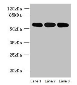Western blot. All lanes: STK33 antibody at 4µg/ml. Lane 1: Mouse kidney tissue. Lane 2: Hela whole cell lysate. Lane 3: Jurkat whole cell lysate. Secondary. Goat polyclonal to rabbit IgG at 1/10000 dilution. Predicted band size: 58, 51 kDa. Observed band size: 58 kDa