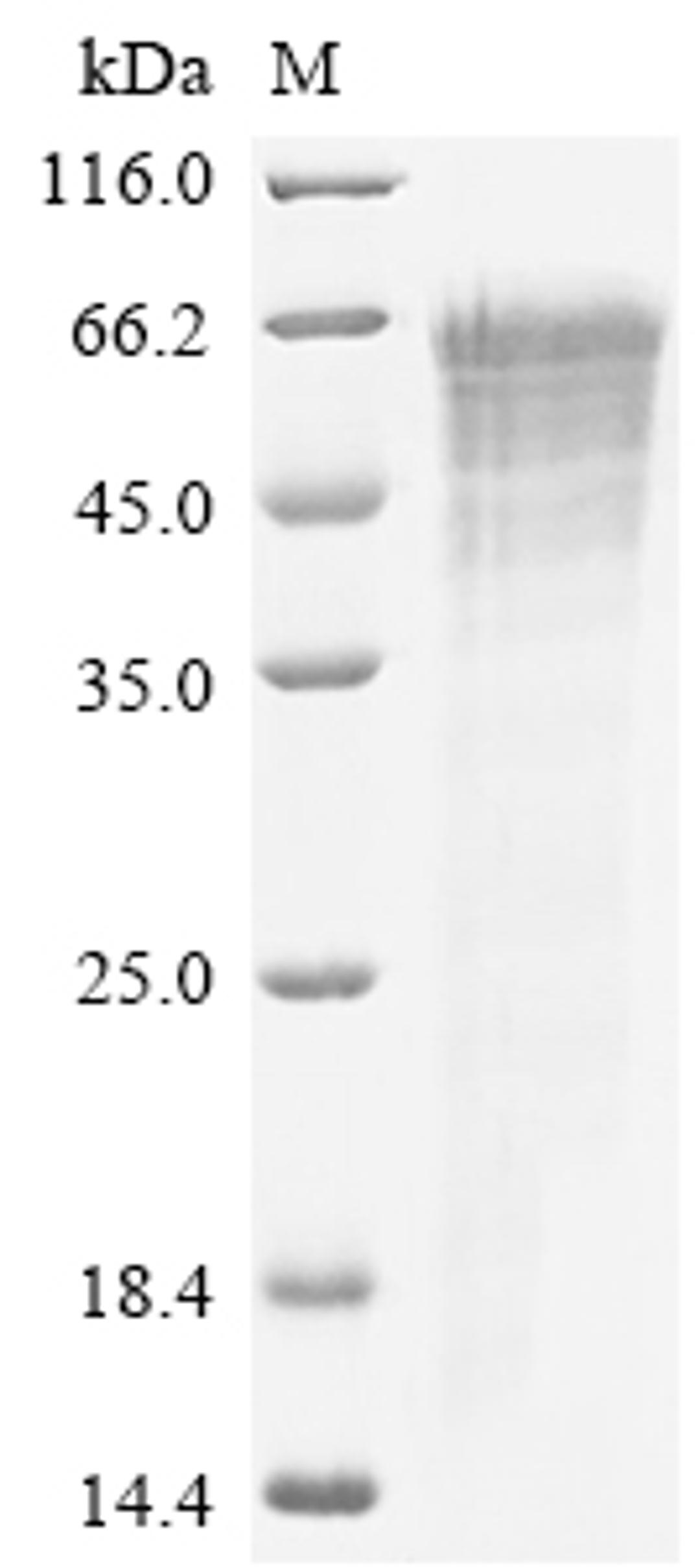 (Tris-Glycine gel) Discontinuous SDS-PAGE (reduced) with 5% enrichment gel and 15% separation gel.