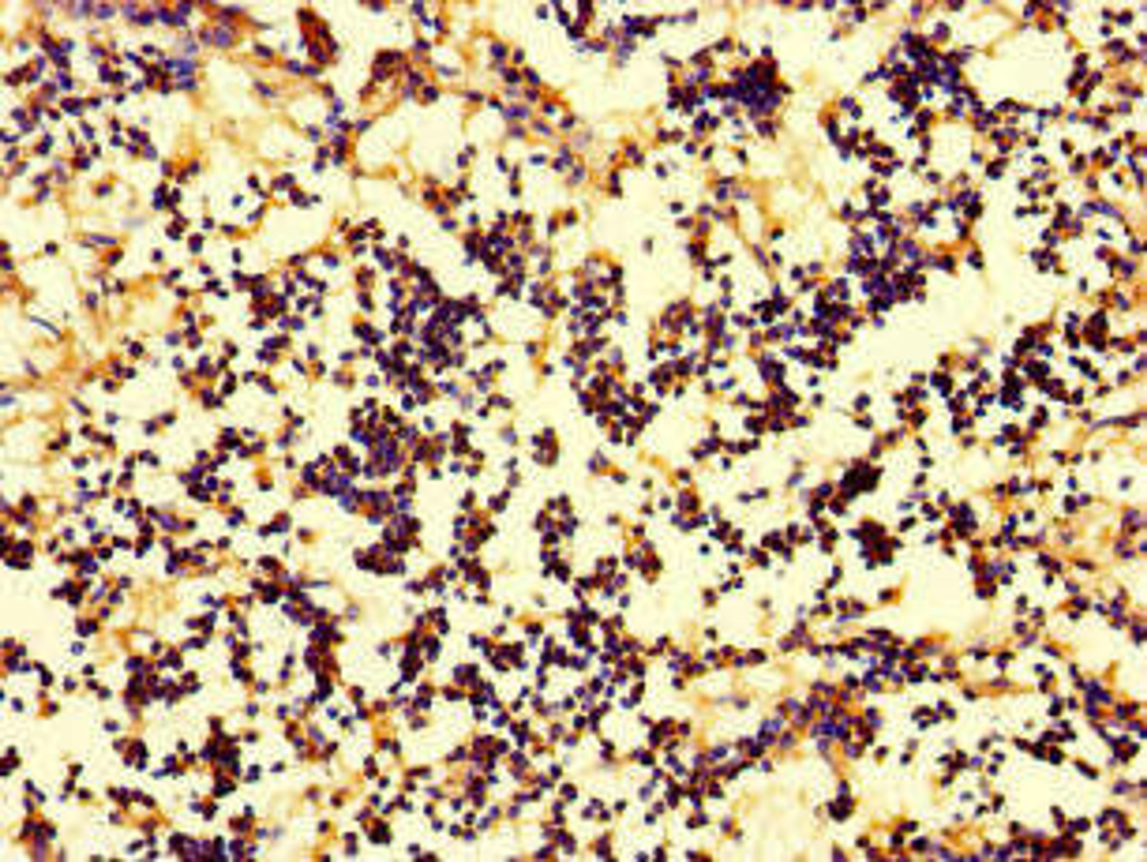 Immunohistochemistry of paraffin-embedded human appendix tissue using CSB-PA06659A0Rb at dilution of 1:100