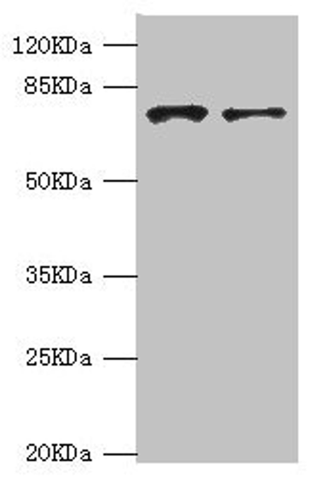 Western blot. All lanes: GBE1 antibody at 3.13ug/ml. Lane 1: HepG2 whole cell lysate. Lane 2: Hela whole cell lysate. Secondary. Goat polyclonal to rabbit IgG at 1/10000 dilution. Predicted band size: 80 kDa. Observed band size: 80 kDa. 