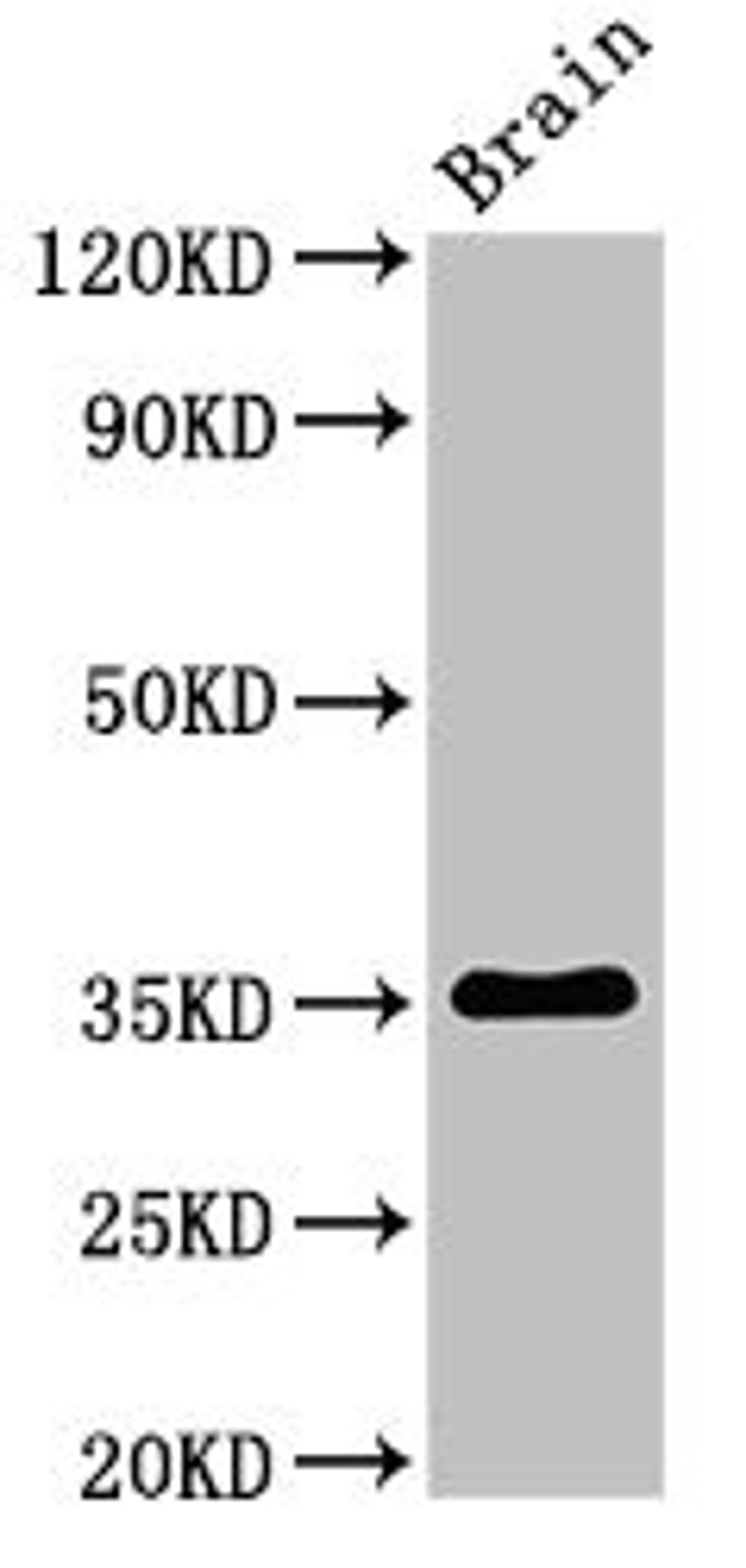 Western Blot. Positive WB detected in: Rat brain tissue. All lanes: Metrnl antibody at 3ug/ml. Secondary. Goat polyclonal to rabbit IgG at 1/50000 dilution. Predicted band size: 35, 36 kDa. Observed band size: 35 kDa. 