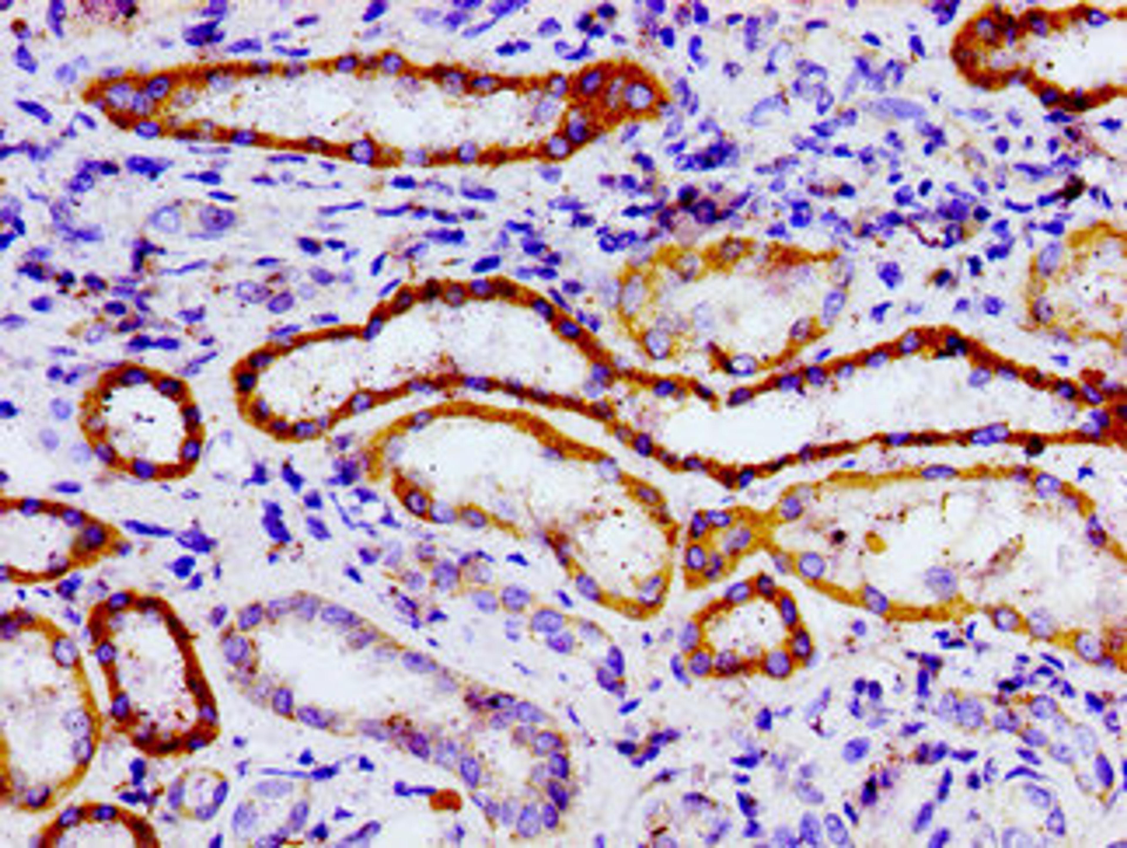 Immunohistochemistry of paraffin-embedded human kidney tissue using CSB-PA856610LA01HU at dilution of 1:100