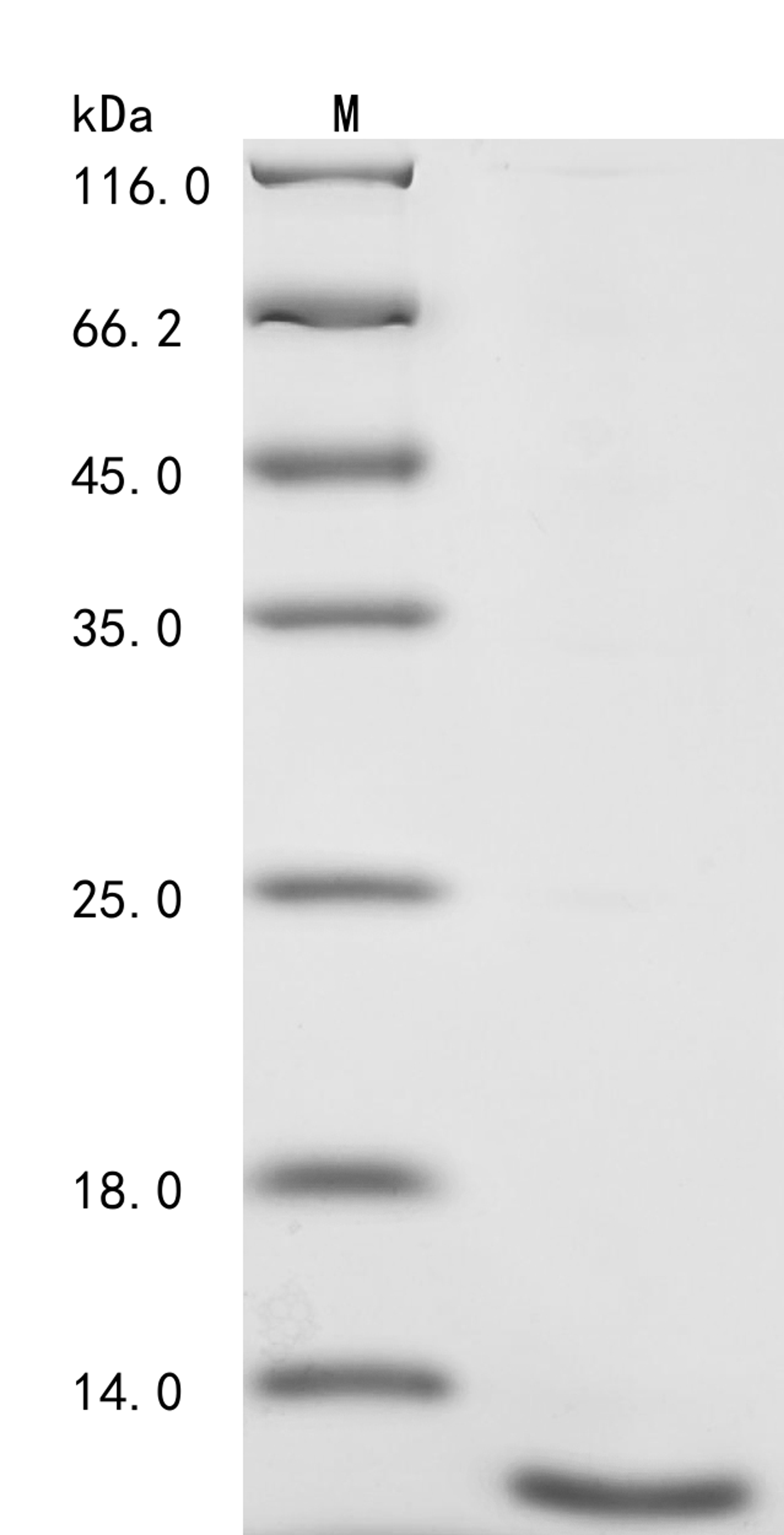(Tris-Glycine gel) Discontinuous SDS-PAGE (reduced) with 5% enrichment gel and 15% separation gel.