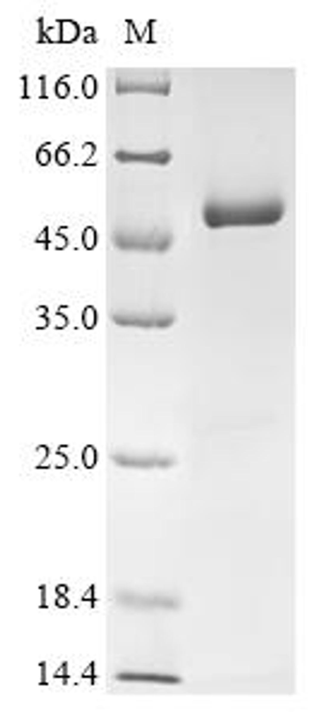 (Tris-Glycine gel) Discontinuous SDS-PAGE (reduced) with 5% enrichment gel and 15% separation gel.