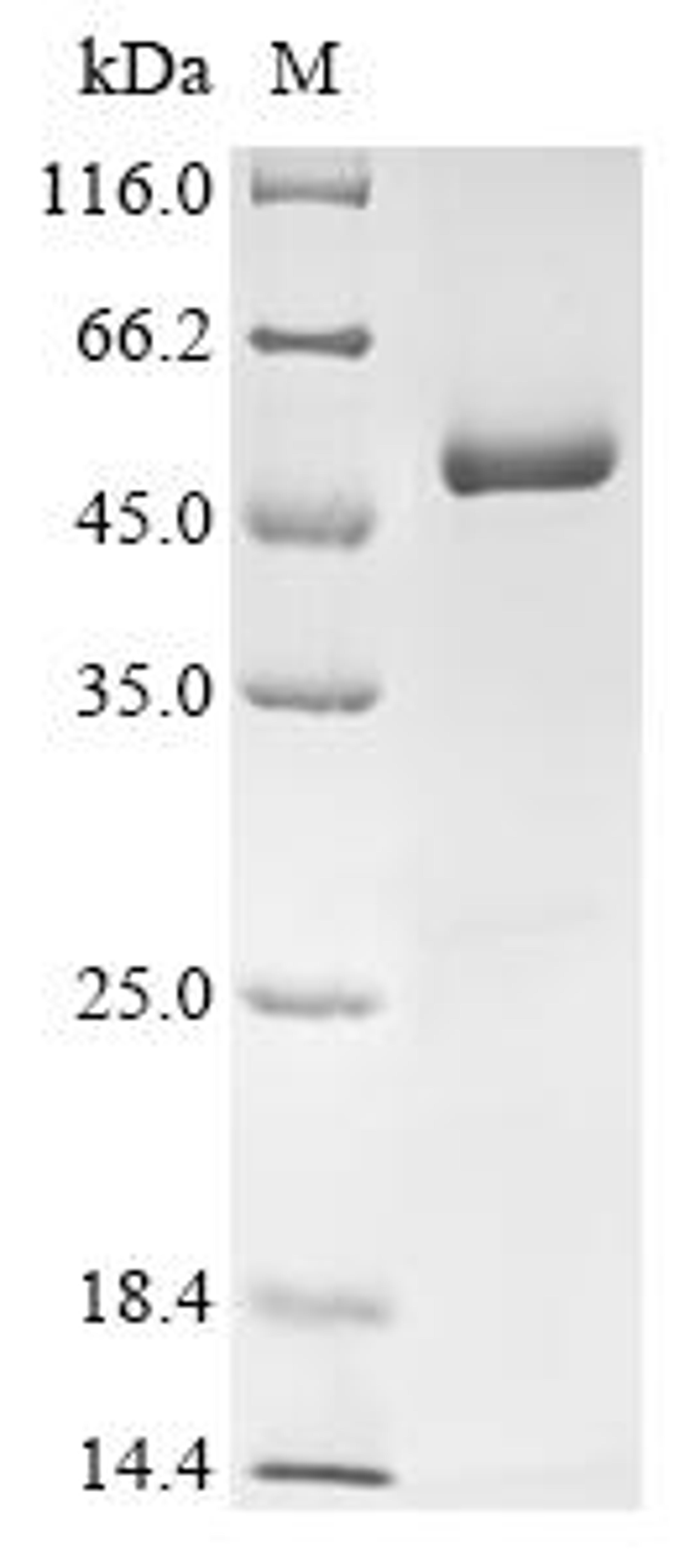 (Tris-Glycine gel) Discontinuous SDS-PAGE (reduced) with 5% enrichment gel and 15% separation gel.