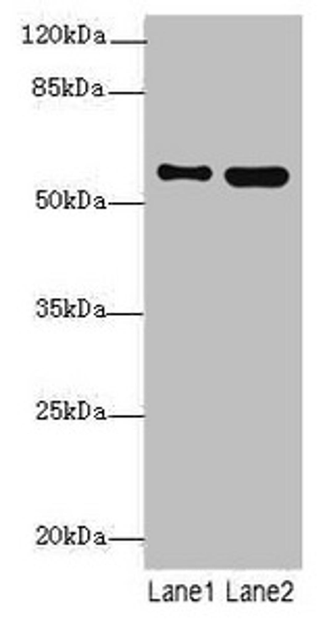 Western blot. All lanes: STAM2 antibody at 4.09µg/ml. Lane 1: 293T whole cell lysate. Lane 2: Hela whole cell lysate. Secondary. Goat polyclonal to rabbit IgG at 1/10000 dilution. Predicted band size: 59, 39 kDa. Observed band size: 59 kDa