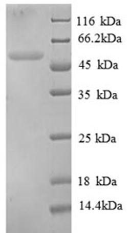 (Tris-Glycine gel) Discontinuous SDS-PAGE (reduced) with 5% enrichment gel and 15% separation gel.