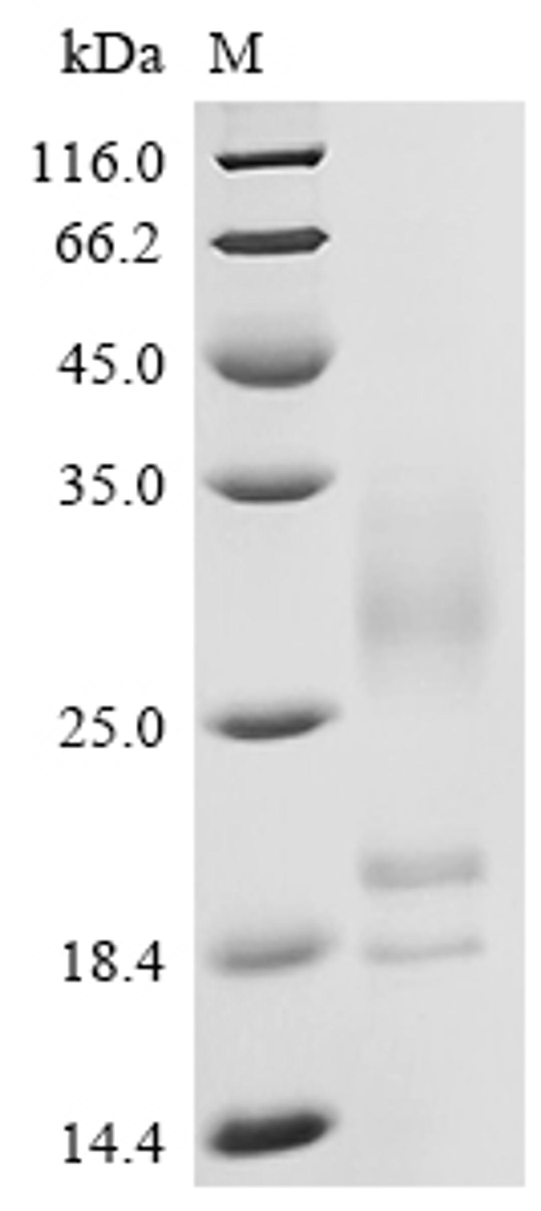 (Tris-Glycine gel) Discontinuous SDS-PAGE (reduced) with 5% enrichment gel and 15% separation gel.