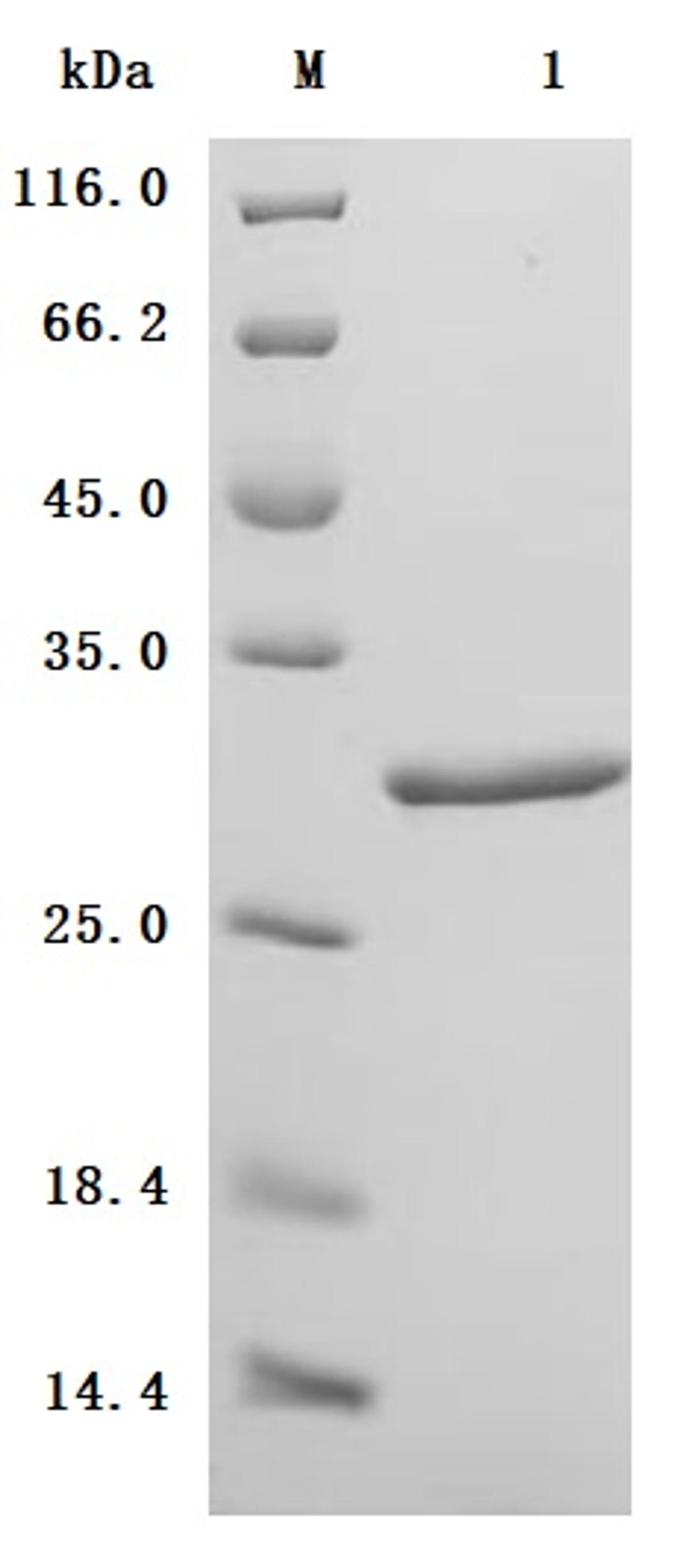 (Tris-Glycine gel) Discontinuous SDS-PAGE (reduced) with 5% enrichment gel and 15% separation gel.