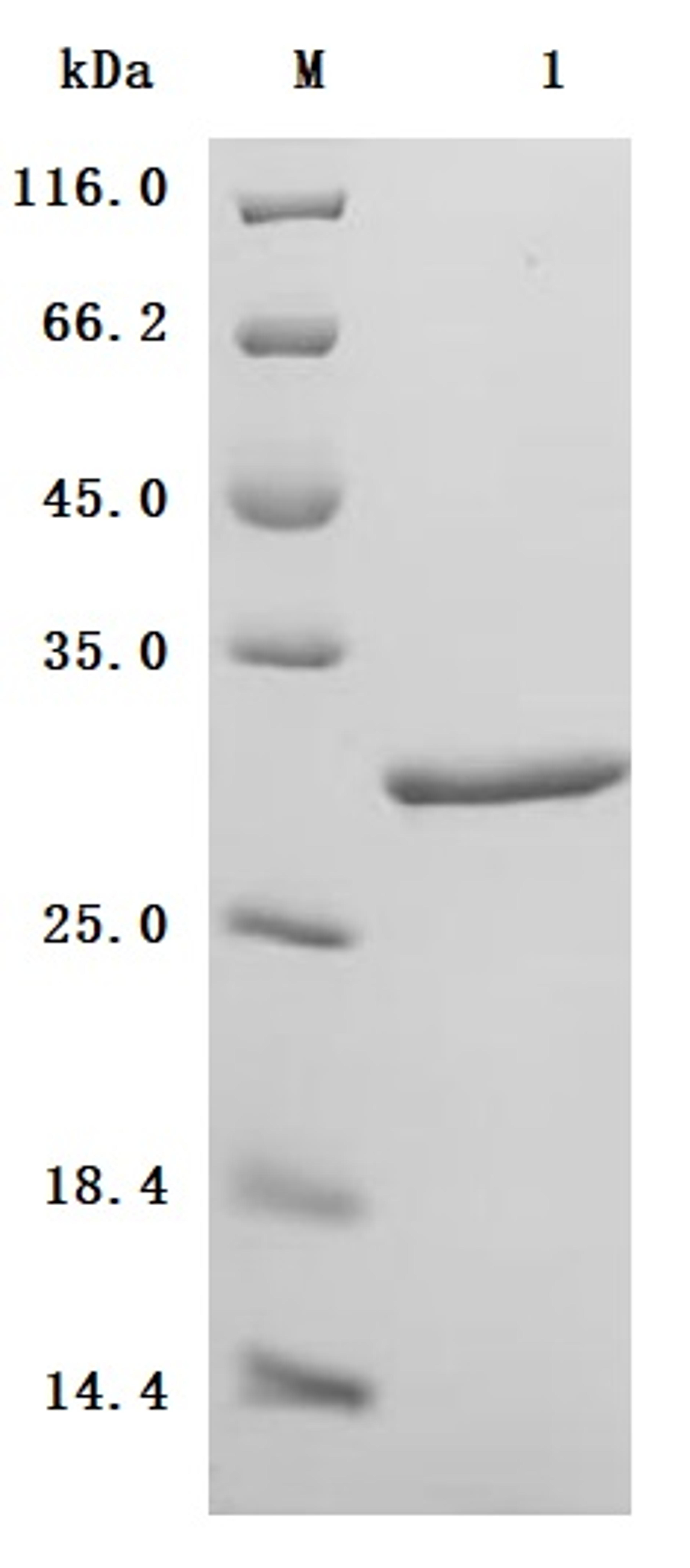 (Tris-Glycine gel) Discontinuous SDS-PAGE (reduced) with 5% enrichment gel and 15% separation gel.