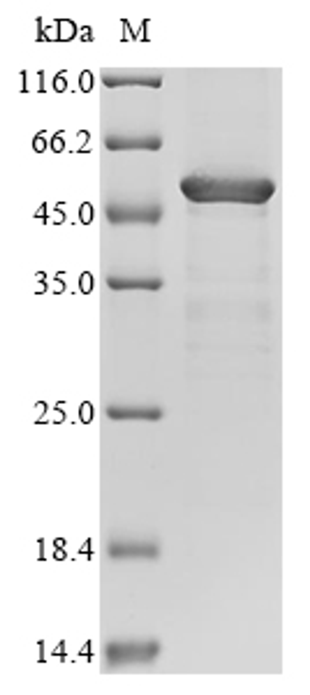 (Tris-Glycine gel) Discontinuous SDS-PAGE (reduced) with 5% enrichment gel and 15% separation gel.