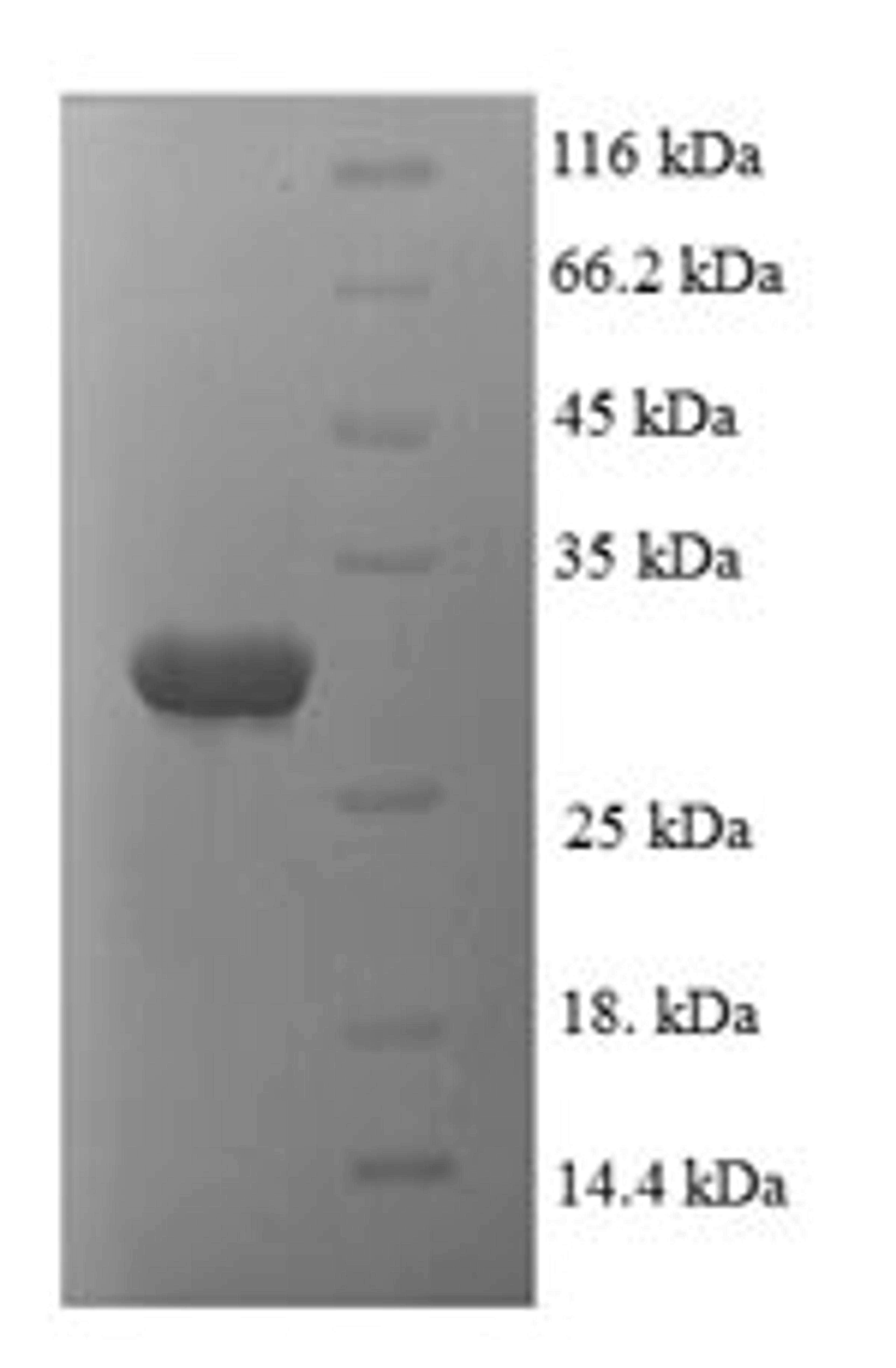 (Tris-Glycine gel) Discontinuous SDS-PAGE (reduced) with 5% enrichment gel and 15% separation gel.