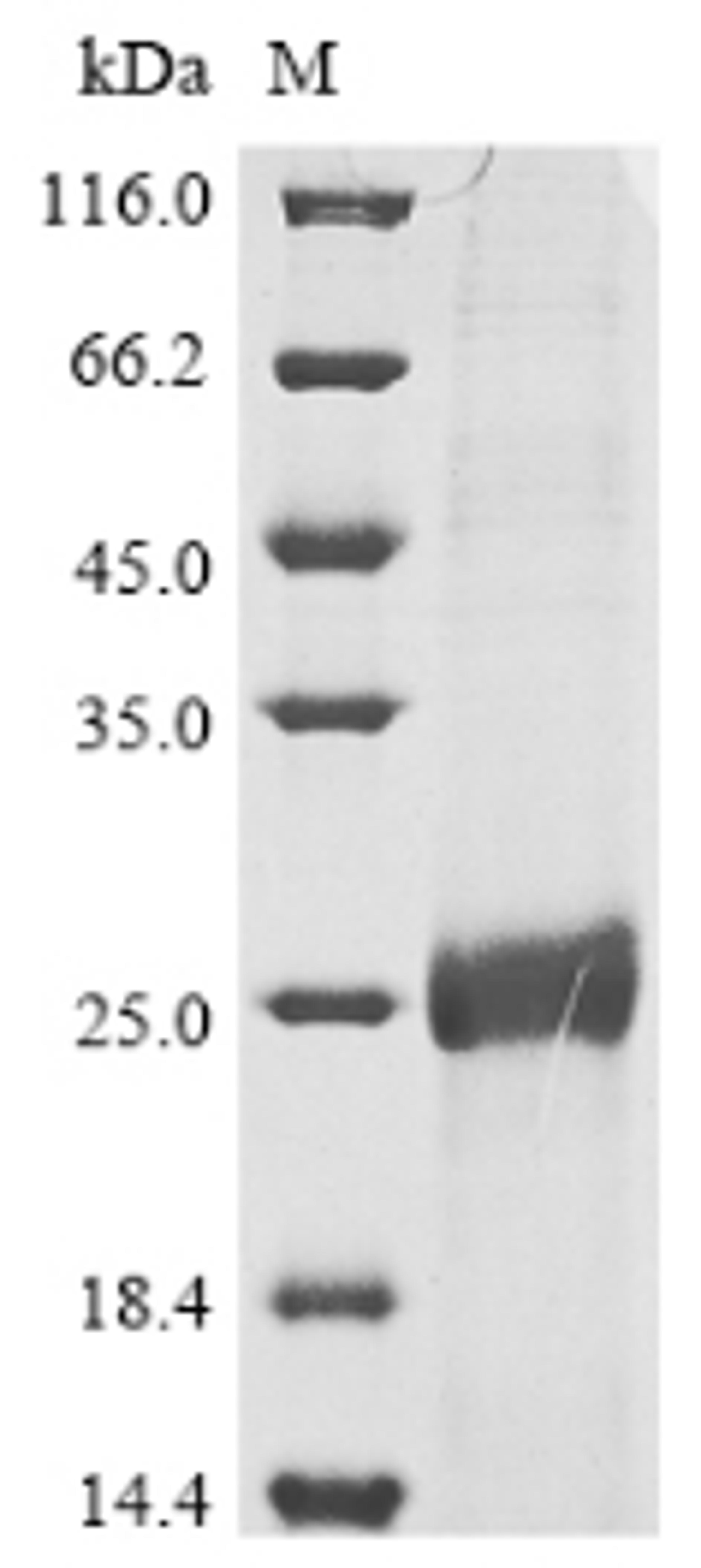(Tris-Glycine gel) Discontinuous SDS-PAGE (reduced) with 5% enrichment gel and 15% separation gel.