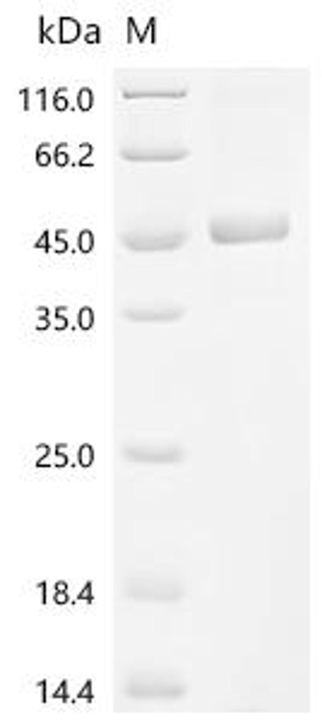 (Tris-Glycine gel) Discontinuous SDS-PAGE (reduced) with 5% enrichment gel and 15% separation gel.