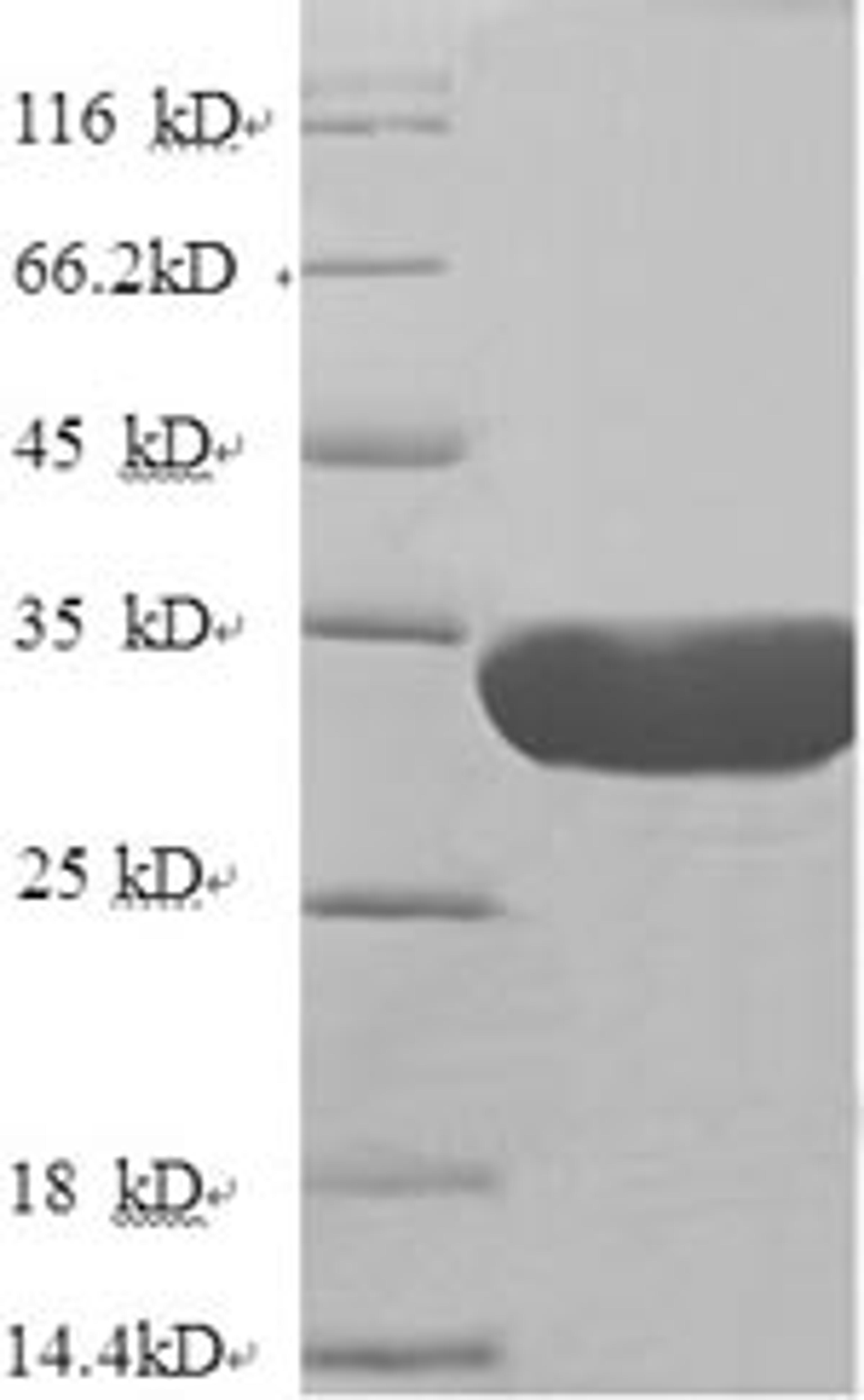 (Tris-Glycine gel) Discontinuous SDS-PAGE (reduced) with 5% enrichment gel and 15% separation gel.