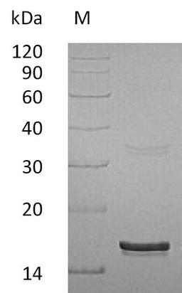 (Tris-Glycine gel) Discontinuous SDS-PAGE (reduced) with 5% enrichment gel and 15% separation gel.