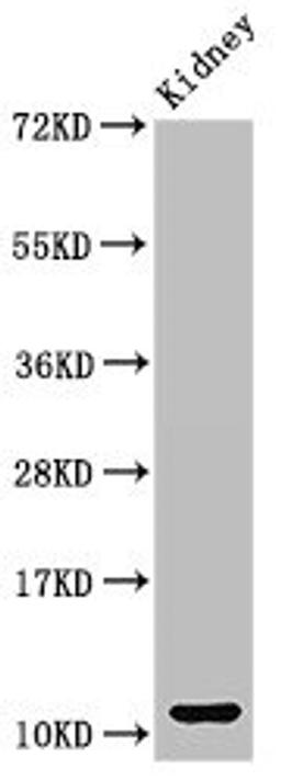 Western Blot. Positive WB detected in: Mouse kidney tissue. All lanes: CCL3 antibody at 3ug/ml. Secondary. Goat polyclonal to rabbit IgG at 1/50000 dilution. Predicted band size: 11 kDa. Observed band size: 11 kDa. 