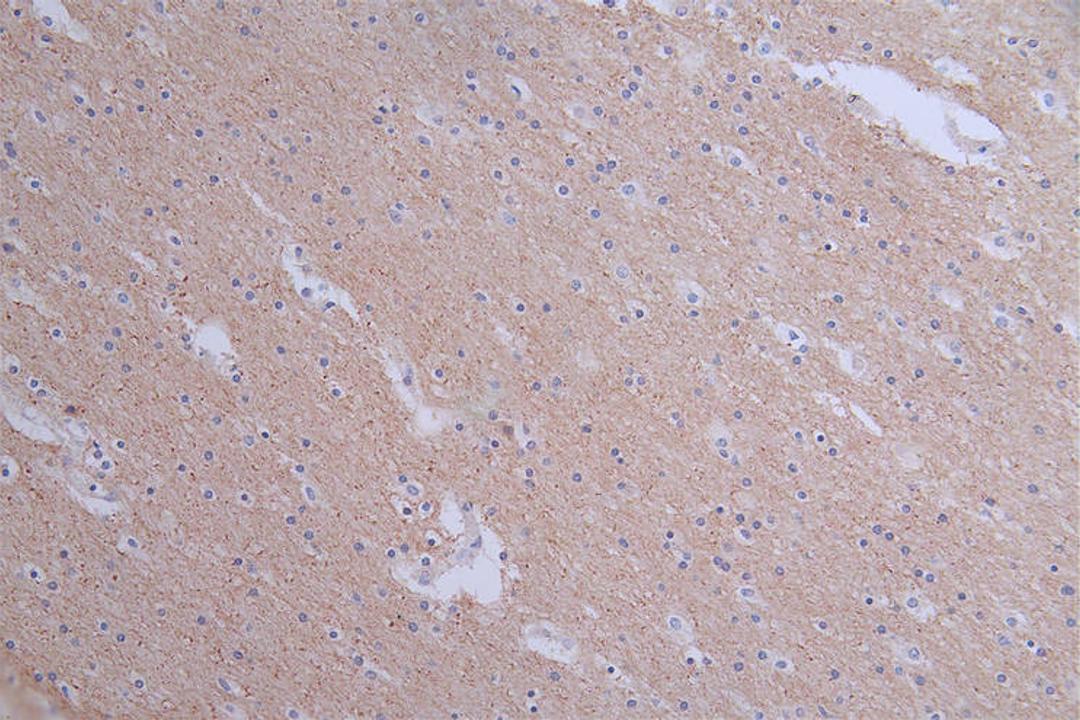 IHC image of CSB-RA549607A0HU diluted at 1:50 and staining in paraffin-embedded human brain tissue performed on a Leica BondTM system. After dewaxing and hydration, antigen retrieval was mediated by high pressure in a citrate buffer (pH 6.0). Section was blocked with 10% normal goat serum 30min at RT. Then primary antibody (1% BSA) was incubated at 4°C overnight. The primary is detected by a Goat anti-rabbit polymer IgG labeled by HRP and visualized using 0.1:50% DAB.