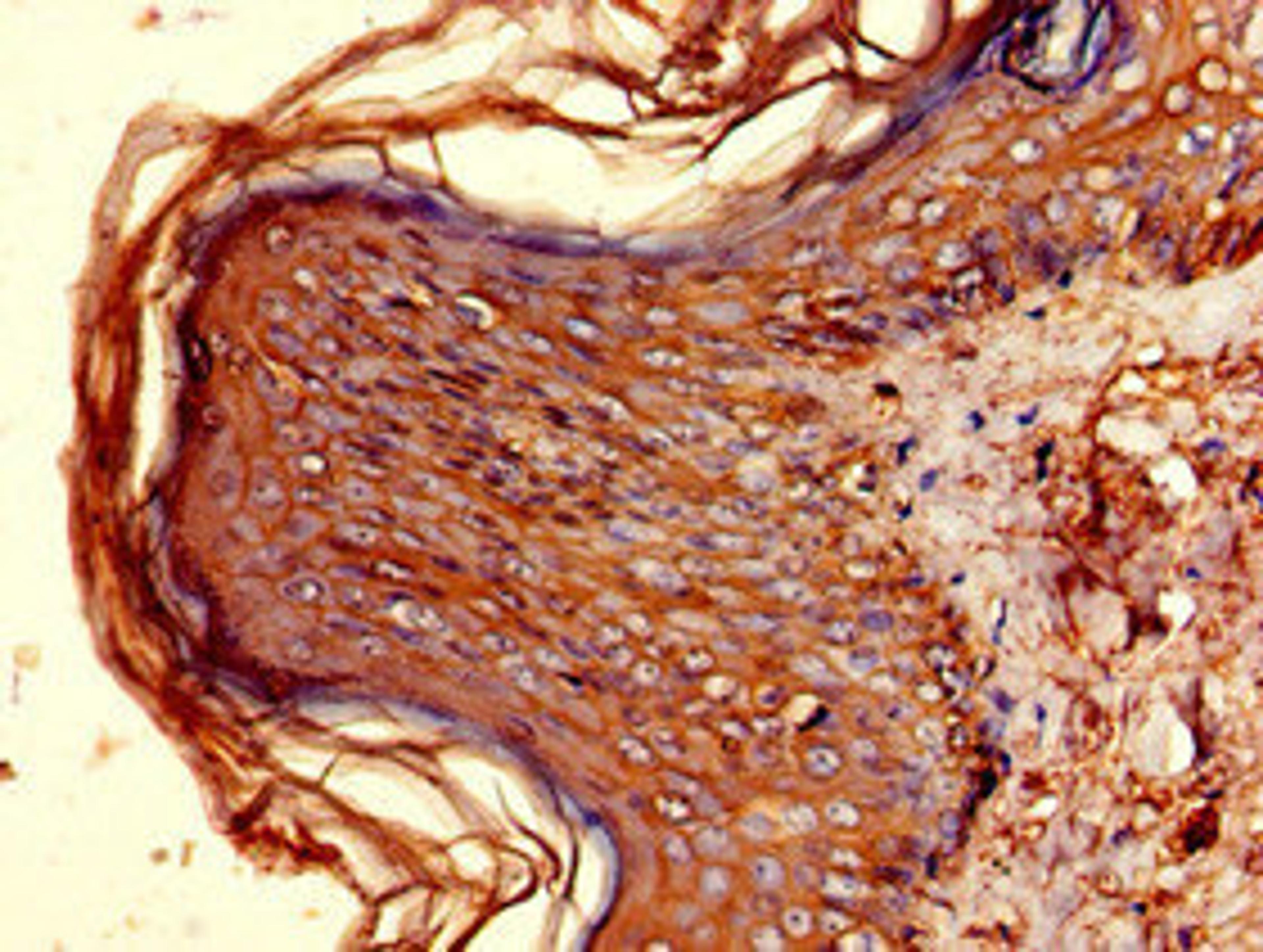 Immunohistochemistry of paraffin-embedded human skin tissue using CSB-PA14849A0Rb at dilution of 1:100
