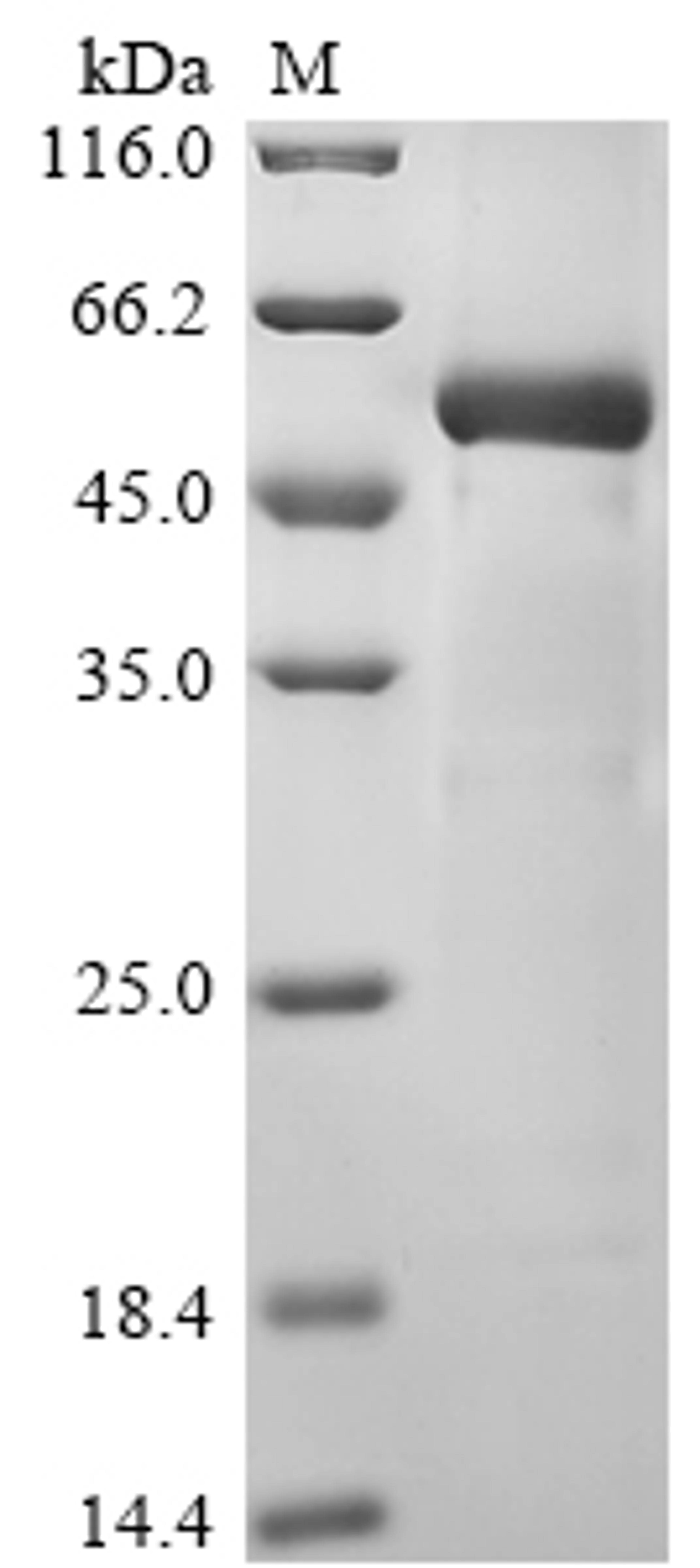 (Tris-Glycine gel) Discontinuous SDS-PAGE (reduced) with 5% enrichment gel and 15% separation gel.