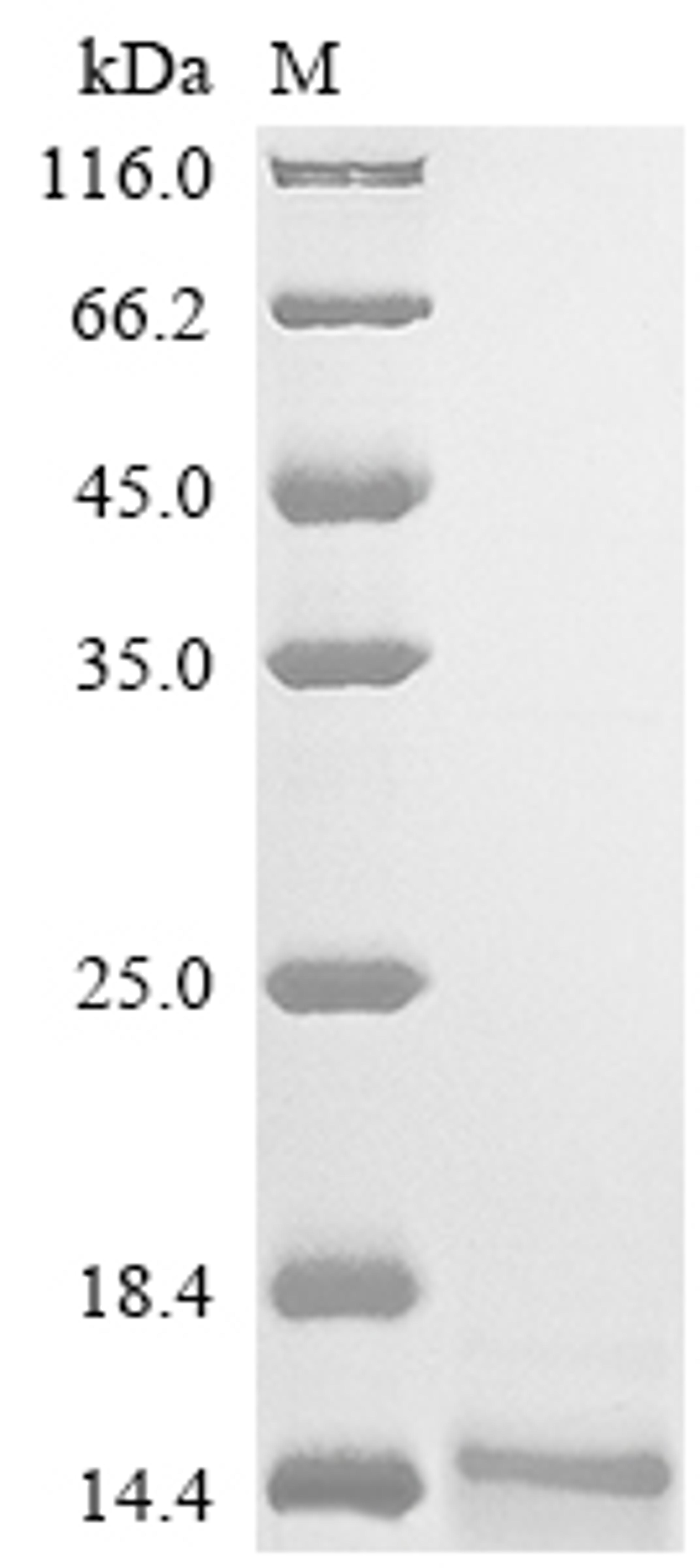 (Tris-Glycine gel) Discontinuous SDS-PAGE (reduced) with 5% enrichment gel and 15% separation gel.