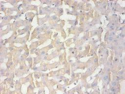 Immunohistochemical of paraffin-embedded human liver tissue using CSB-MA100091A0m at dilution of 1:200  