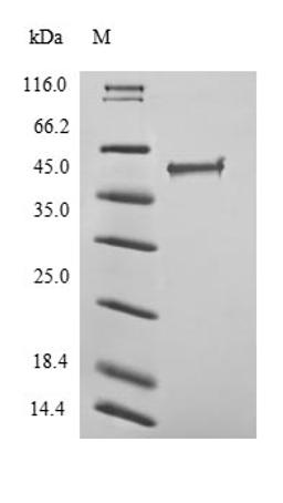 (Tris-Glycine gel) Discontinuous SDS-PAGE (reduced) with 5% enrichment gel and 15% separation gel.