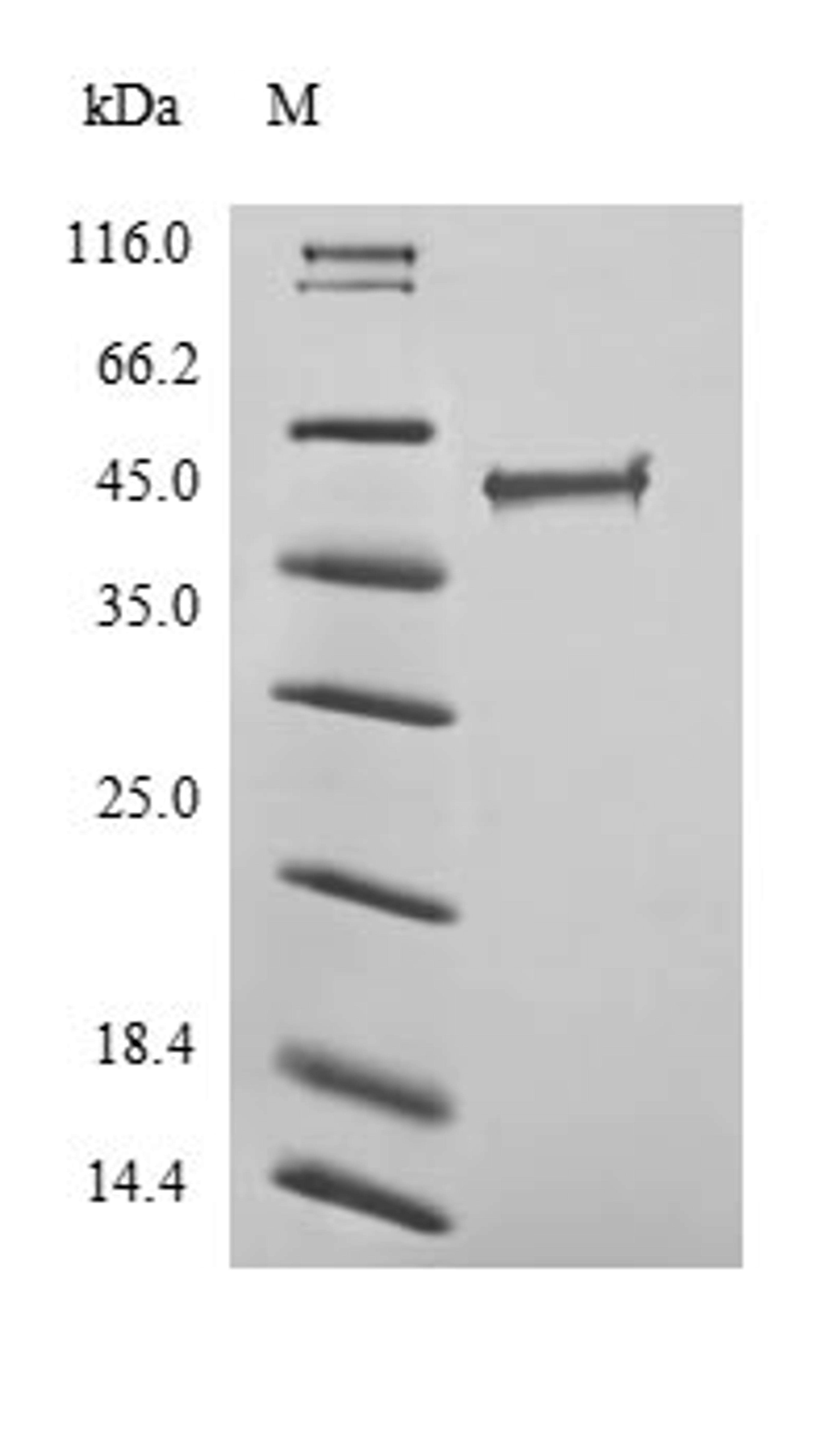 (Tris-Glycine gel) Discontinuous SDS-PAGE (reduced) with 5% enrichment gel and 15% separation gel.