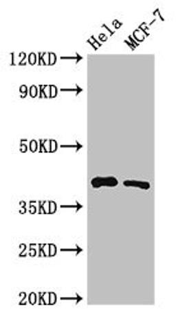 Western Blot. Positive WB detected in: Hela whole cell lysate, MCF-7 whole cell lysate. All lanes: HLA-B antibody at 3.2µg/ml. Secondary. Goat polyclonal to rabbit IgG at 1/50000 dilution. Predicted band size: 41 kDa. Observed band size: 41 kDa