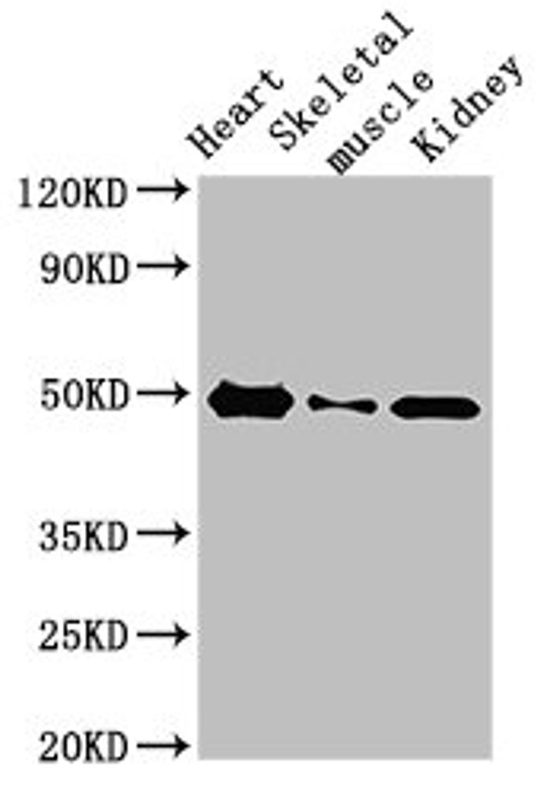 Western Blot. Positive WB detected in: Rat heart tissue, Rat skeletal muscle, Mouse kidney tissue. All lanes: ATP6V1C2 antibody at 3.4ug/ml. Secondary. Goat polyclonal to rabbit IgG at 1/50000 dilution. Predicted band size: 49, 44 kDa. Observed band size: 49 kDa. 