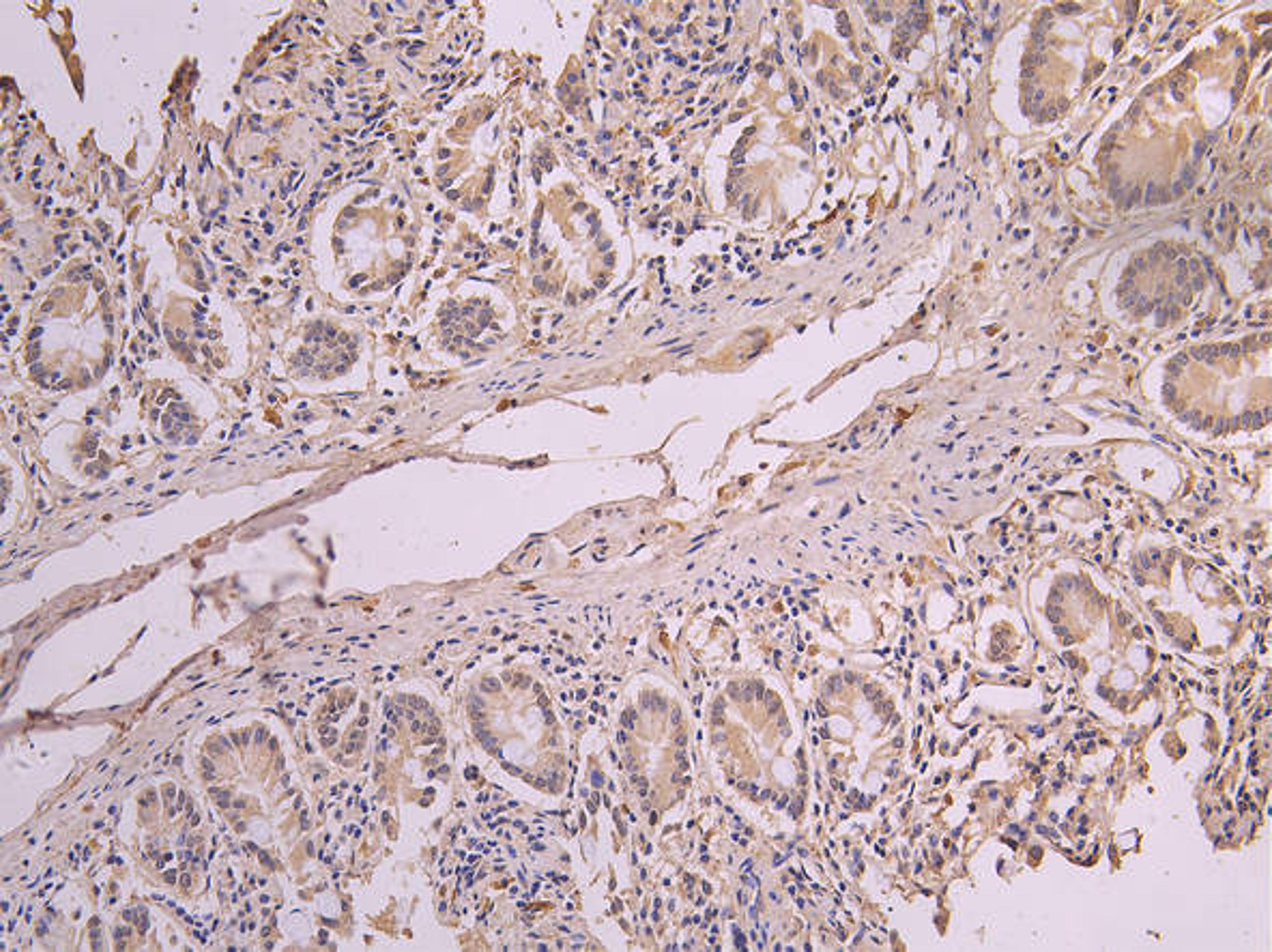 IHC image of CSB-RA007759MA1HU diluted at 1:200 and staining in paraffin-embedded human small intestine tissue performed on a Leica BondTM system. After dewaxing and hydration, antigen retrieval was mediated by high pressure in a citrate buffer (pH 6.0). Section was blocked with 10% normal goat serum 30min at RT. Then primary antibody (1% BSA) was incubated at 4°C overnight. The primary is detected by a Goat anti-human polymer IgG labeled by HRP and visualized using 0.05% DAB.