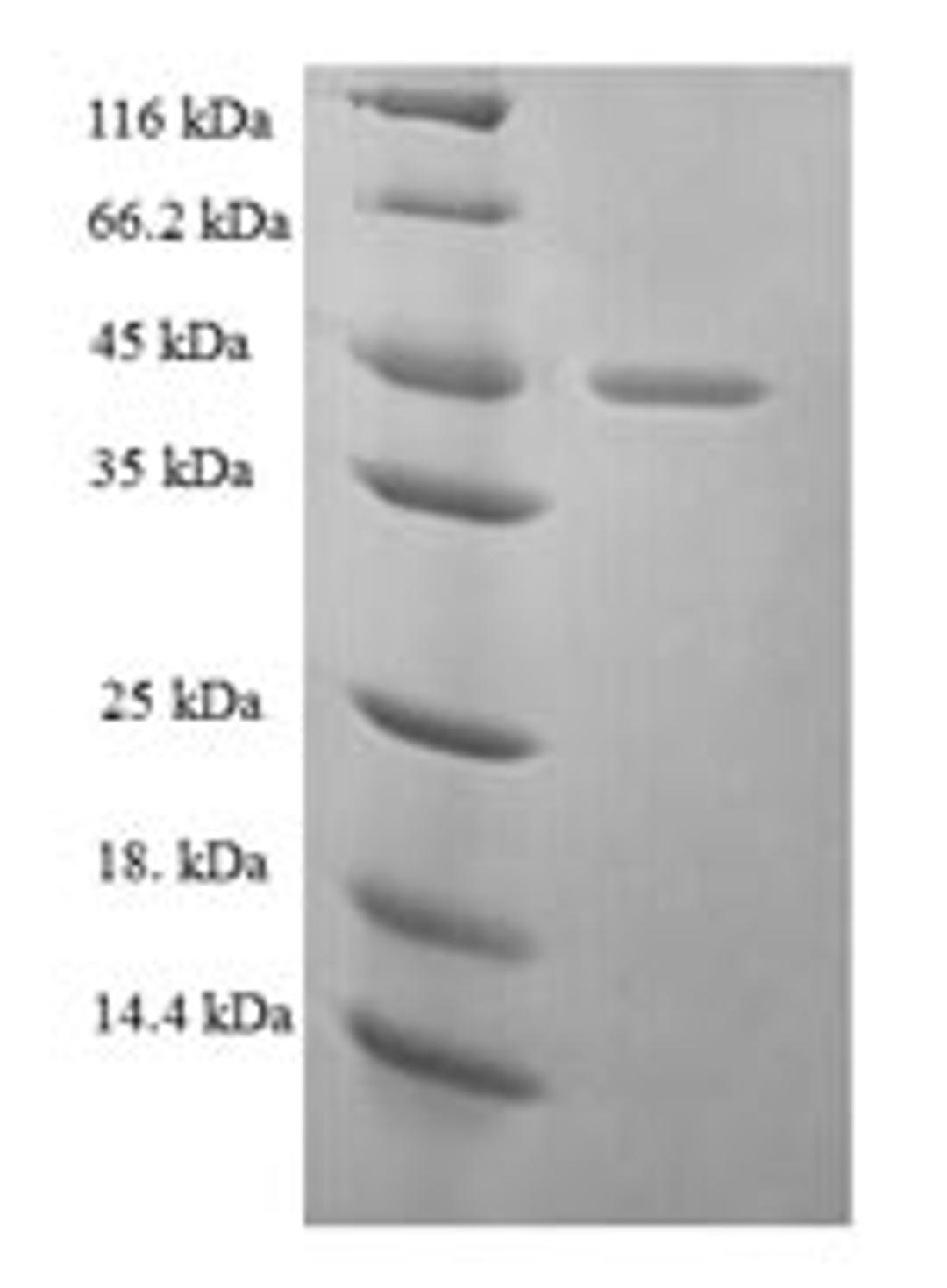 (Tris-Glycine gel) Discontinuous SDS-PAGE (reduced) with 5% enrichment gel and 15% separation gel.