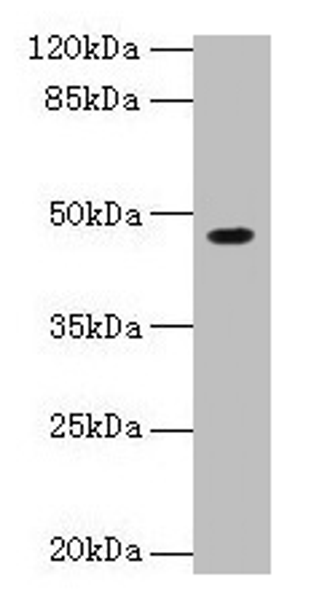 Western blot. All lanes: NXF5 antibody at 4µg/ml + HL60 whole cell lysate. Secondary. Goat polyclonal to rabbit IgG at 1/10000 dilution. Predicted band size: 46, 43, 20, 36, 35 kDa. Observed band size: 46 kDa