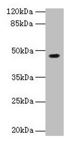Western blot. All lanes: NXF5 antibody at 4µg/ml + HL60 whole cell lysate. Secondary. Goat polyclonal to rabbit IgG at 1/10000 dilution. Predicted band size: 46, 43, 20, 36, 35 kDa. Observed band size: 46 kDa