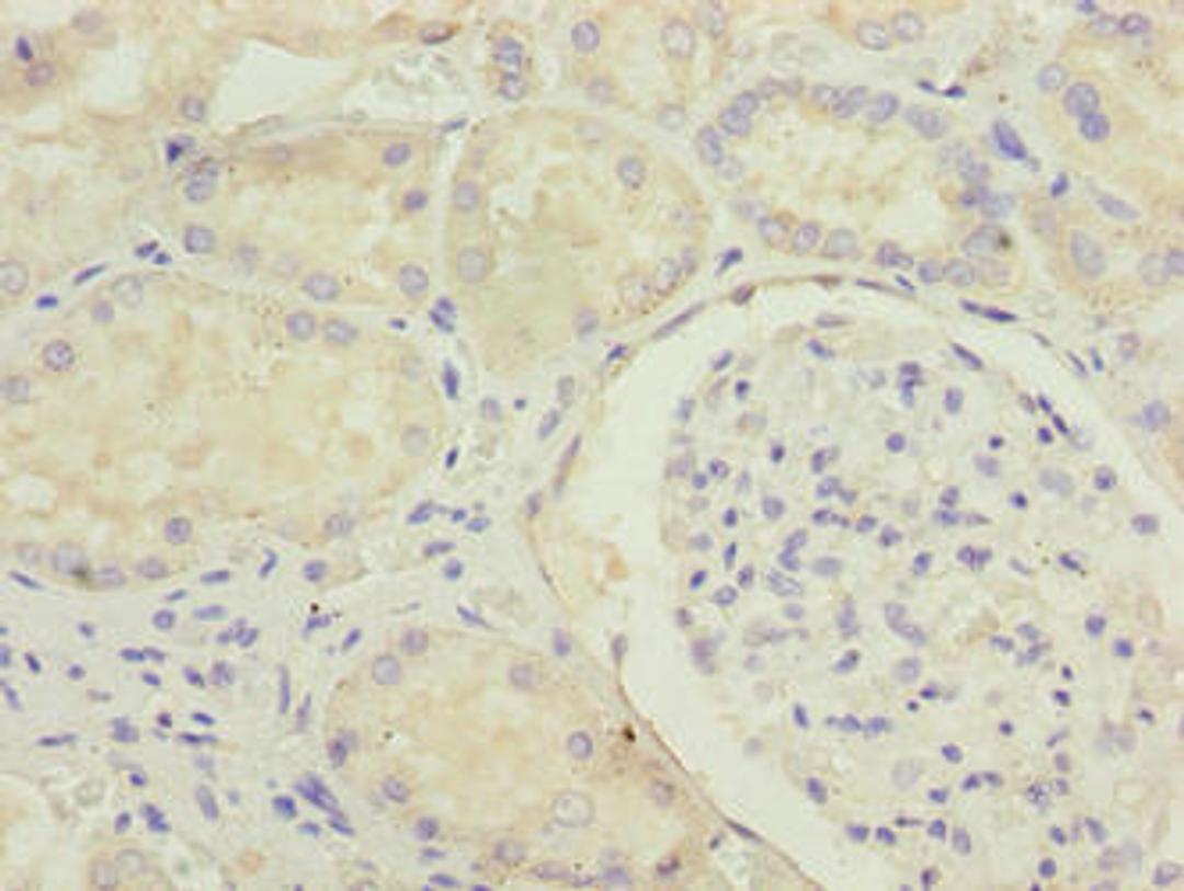 Immunohistochemistry of paraffin-embedded human kidney tissue using CSB-PA620882LA01HU at dilution of 1:100