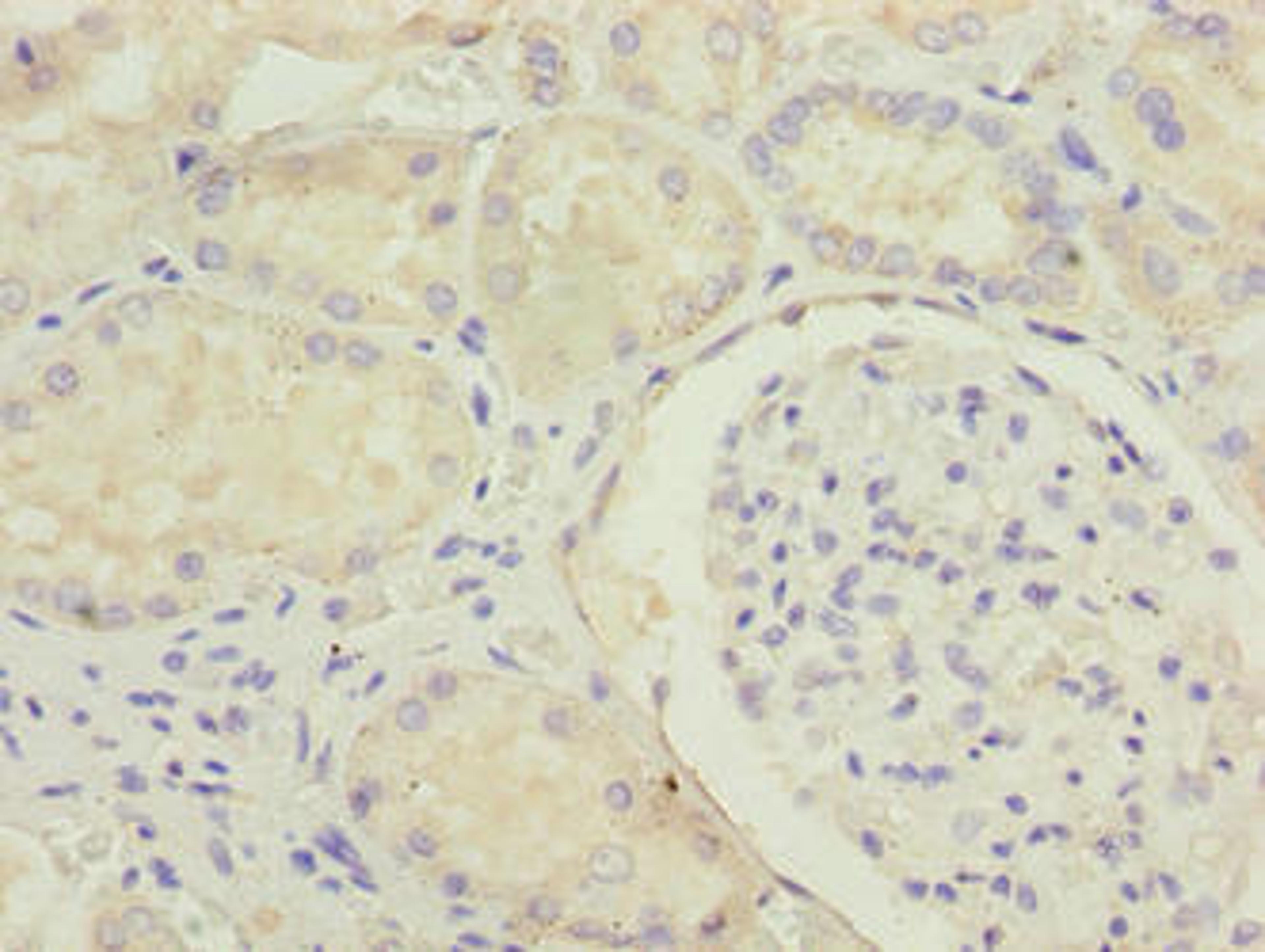 Immunohistochemistry of paraffin-embedded human kidney tissue using CSB-PA620882LA01HU at dilution of 1:100