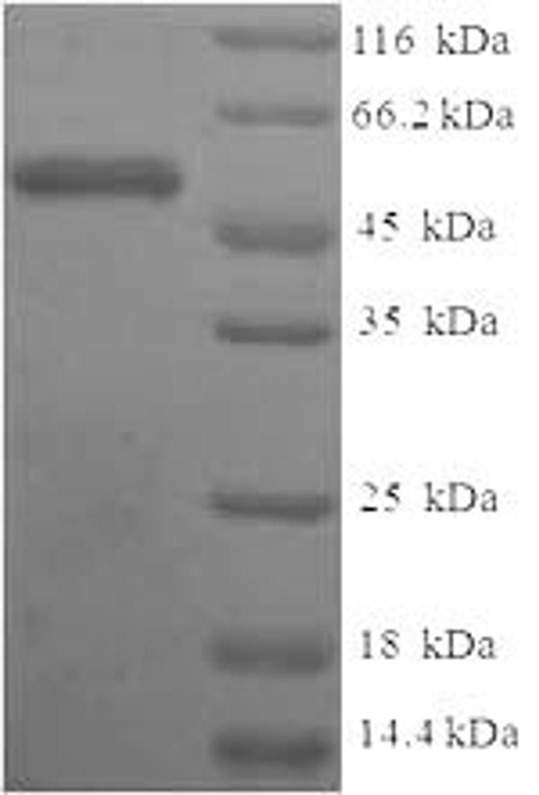 (Tris-Glycine gel) Discontinuous SDS-PAGE (reduced) with 5% enrichment gel and 15% separation gel.